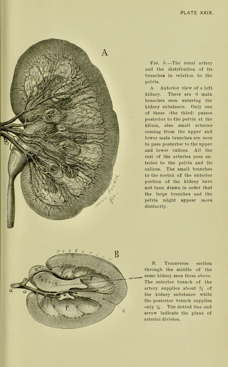 Fig. 3.—The renal artery and the distribution of its branches in relation to the pelvis. A. Anterior view of a left kidney. There are (5 main branches seen entering the kidney substance. Only one of these (the third) passes posterior to the pelvis at the hilum, also small arteries coming from the upper and lower main branches are seen to pass posterior to the upper and lower calices. All the rest of the arteries pass an- terior to the pelvis and its calices. The small branches to the cortex of the anterior portion of the kidney have not been drawn in order that the large branches and the pelvis might appear more distinctly. B. Transverse section through the middle of the same kidney seen from above. The anterior branch of the artery supplies about % of the kidney substance while the posterior branch supplies only The dotted line and arrow indicate the plane of arterial division.