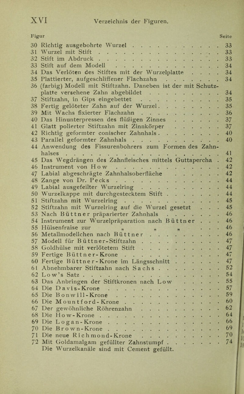 Figur Seite 30 Richtig ausgebohrte Wurzel 33 31 Wurzel mit Stift 33 32 Stift im Abdruck 33 33 Stift auf dem Modell 34 34 Das Verlöten des Stiftes mit der Wurzelplatte .... 34 35 Plattierter, aufgeschliffener Flachzahn 34 36 (farbig) Modell mit Stiftzahn. Daneben ist der mit Schutz- platte versehene Zahn abgebildet 34 37 Stiftzahn, in Gips eingebettet 35 38 Fertig gelöteter Zahn auf der Wurzel 35 39 Mit Wachs fixierter Flachzahn 36 40 Das Hinunterpressen des flüßigen Zinnes 37 41 Glatt polierter Stiftzahn mit Zinnkörper 37 42 Richtig geformter conischer Zahnhals 40 43 Parallel geformter Zahnhals 40 44 Anwendung des Fissurenbohrers zum Formen des Zahn- halses 41 45 Das Wegdrängen des Zahnfleisches mittels Guttapercha . 42 46 Instrument von How 42 47 Labial abgeschrägte Zahnhalsoberfläche 42 48 Zange von Dr. Pecks 44 49 Labial ausgefeilter Wurzelring 44 50 Wurzelkappe mit durchgestecktem Stift 44 51 Stiftzahn mit Wurzelring 45 52 Stiftzahn mit Wurzelring auf die Wurzel gesetzt ... 45 53 Nach Büttner präparierter Zahnhals 46 54 Instrument zur Wurzelpräparation nach Büttner . . . 46 55 Hülsenfraise zur „ „ „ ... 46 56 Metallmodellchen nach Büttner 46 57 Modell für Büttner-Stiftzahn 47 58 Goldhülse mit verlötetem Stift 47 59 Fertige Bütt n e r-Krone 47 60 Fertige Büttne r-Krone im Längsschnitt 47 61 Abnehmbarer Stiftzahn nach Sachs 52 62 Low’s Satz 54 63 Das Anbringen der Stiftkronen nach Low 55 64 Die Da vis-Krone 57 65 Die B o n w i 11 - Krone 59 66 Die M ou n t f o rd - Krone 60 67 Der gewöhnliche Röhrenzahn 62 68 Die How-Krone 64 69 Die Logan-Krone 66 70 Die Brown-Krone 69 71 Die neue R i c h mon d-Krone 70 72 Mit Goldamalgam gefüllter Zahnslumpf 74 Die Wurzelkanäle sind mit Cement gefüllt.
