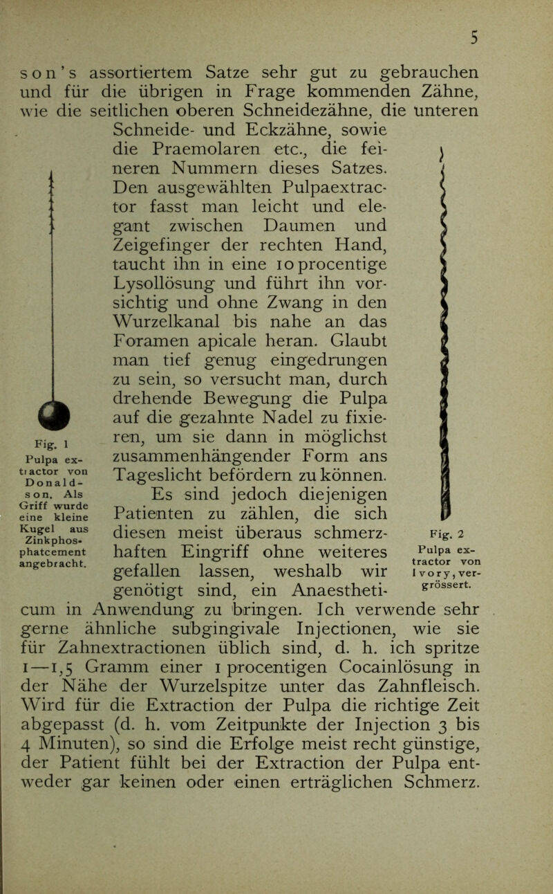 s o n ’ s assortiertem Satze sehr gut zu gebrauchen und für die übrigen in Frage kommenden Zähne, wie die seitlichen oberen Schneidezähne, die unteren Schneide- und Eckzähne, sowie die Praemolaren etc., die fei- ) neren Nummern dieses Satzes. Den ausgewählten Pulpaextrac- tor fasst man leicht und ele- gant zwischen Daumen und Zeigefinger der rechten Hand, taucht ihn in eine loprocentige Lysollösung und führt ihn vor- sichtig und ohne Zwang in den Wurzelkanal bis nahe an das Foramen apicale heran. Glaubt man tief genug eingedrungen zu sein, so versucht man, durch drehende Bewegung die Pulpa auf die gezahnte Nadel zu fixie- ren, um sie dann in möglichst zusammenhängender Form ans Tageslicht befördern zu können. Es sind jedoch diejenigen Patienten zu zählen, die sich diesen meist überaus schmerz- haften Eingriff ohne weiteres gefallen lassen, weshalb wir genötigt sind, ein Anaestheti- cum in Anwendung zu bringen. Ich verwende sehr gerne ähnliche sübgingivale Injectionen, wie sie für Zahnextractionen üblich sind, d. h. ich spritze I —1,5 Gramm einer i procentigen Cocainlösung in der Nähe der Wurzelspitze unter das Zahnfleisch. Wird für die Extraction der Pulpa die richtige Zeit abgepasst (d. h. vom Zeitpunkte der Injection 3 bis 4 Minuten), so sind die Erfolge meist recht günstige, der Patient fühlt bei der Extraction der Pulpa ent- weder gar keinen oder einen erträglichen Schmerz. Fig. 1 Pulpa ex- tiactor von Donald- son. Als Griff wurde eine kleine Kugel aus Zinkphos- phatcement angebracht. Fig. 2 Pulpa ex- tractor von 1 vory, ver- grössert.