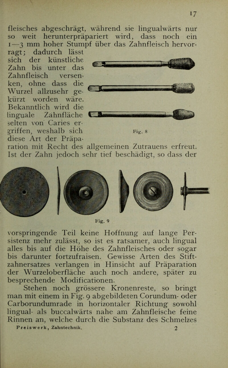 fleisches abgeschrägt, während sie lingualwärts nur so weit herunterpräpariert wird, dass noch ein I—3 mm hoher Stumpf über das Zahnfleisch hervor- ragt ; dadurch lässt sich der künstliche Zahn bis unter das Zahnfleisch versen- ken, ohne dass die Wurzel allzusehr ge- kürzt worden wäre. Bekanntlich wird die linguale Zahnfläche selten von Caries er- griffen, weshalb sich diese Art der Präpa- ration mit Recht des allgemeinen Zutrauens erfreut. Ist der Zahn jedoch sehr tief beschädigt, so dass der C3C Fig. 8 Fig. 9 vorspringende Teil keine Hoffnung auf lange Per- sistenz mehr zulässt, so ist es ratsamer, auch lingual alles bis auf die Höhe des Zahnfleisches oder sogar bis darunter fortzufraisen. Gewisse Arten des Stift- zahnersatzes verlangen in Hinsicht auf Präparation der Wurzeloberfläche auch noch andere, später zu besprechende Modificationen. Stehen noch grössere Kronenreste, so bringt man mit einem in Fig. 9 abgebildeten Corundum- oder Carborundumrade in horizontaler Richtung sowohl lingual- als buccalwärts nahe am Zahnfleische feine Rinnen an, welche durch die Substanz des Schmelzes Preiswerk, Zahntechnik. 2