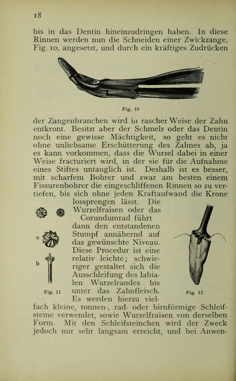 bis in das Dentin hineinzudringen haben. In diese Rinnen werden nun die Schneiden einer Zwickzange, Fig. IO, angesetzt, und durch ein kräftiges Zudrücken Fig. 10 der Zangenbranchen wird iii rascher Weise der Zahn entkront. Besitzt aber der Schmelz oder das Dentin noch eine gewisse Mächtigkeit, so geht es nicht ohne unliebsame Erschütterung des Zahnes ab, ja es kann Vorkommen, dass die Wurzel dabei in einer Weise fracturiert wird, in der sie für die Aufnahme eines Stiftes untauglich ist. Deshalb ist es besser, mit scharfem Bohrer und zwar am besten einem Fissurenbohrer die eingeschliffenen Rinnen so zu ver- tiefen, bis sich ohne jeden Kraftaufwand die Krone lossprengen lässt. Die Wurzelfraisen oder das Corundumrad führt dann den entstandenen Stumpf annähernd auf das gewünschte Niveau. Diese Procedur ist eine relativ leichte; schwie- riger gestaltet sich die Ausschleifung des labia- len Wurzelrandes bis unter das- Zahnfleisch. Es werden hierzu viel- fach kleine, tonnen-, rad- oder bimförmige Schleif- steine verwendet, sowie Wurzelfraisen von derselben Form. Mit den Schleifsteinchen wird der Zweck jedoch nur sehr langsam erreicht, und bei Anwen- Fig. 11