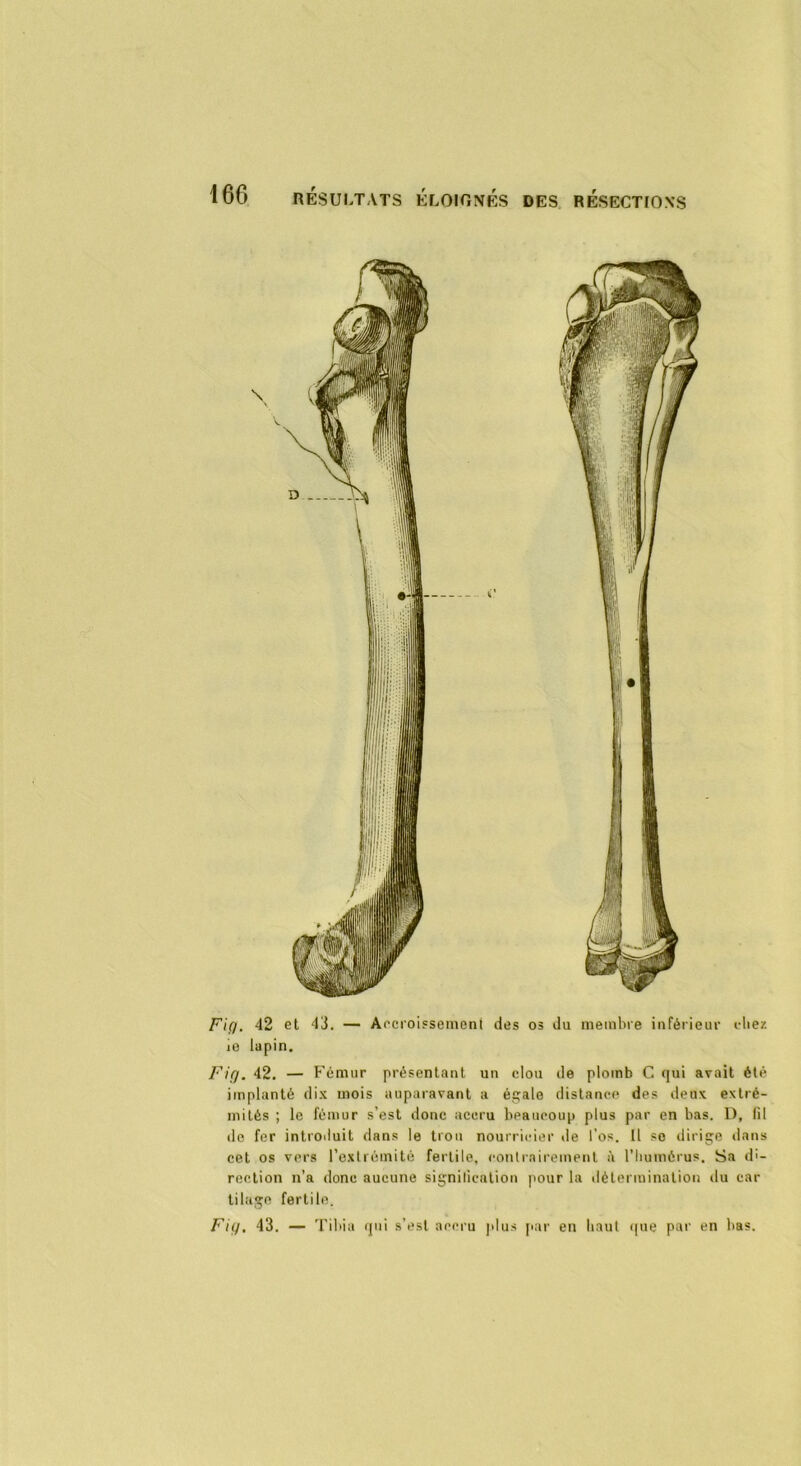 Fig. 42 et 43. — Accroissement des os du membre inférieur die/. io lapin. Fig. 42. — Fémur présentant un clou de plomb C qui avait été implanté dix mois auparavant a égale distance des deux extré- mités ; le fémur s’est donc accru beaucoup plus par en bas. D, lïi de fer introduit dans le trou nourricier de l’os. 11 se dirige dans cet os vers l’extrémité fertile, contrairement il l’humérus. Sa di- rection n’a donc aucune signilication pour la détermination du car tilage fertile. Fig. 43. — Tibia qui s’est accru plus par en haut que par en bas.