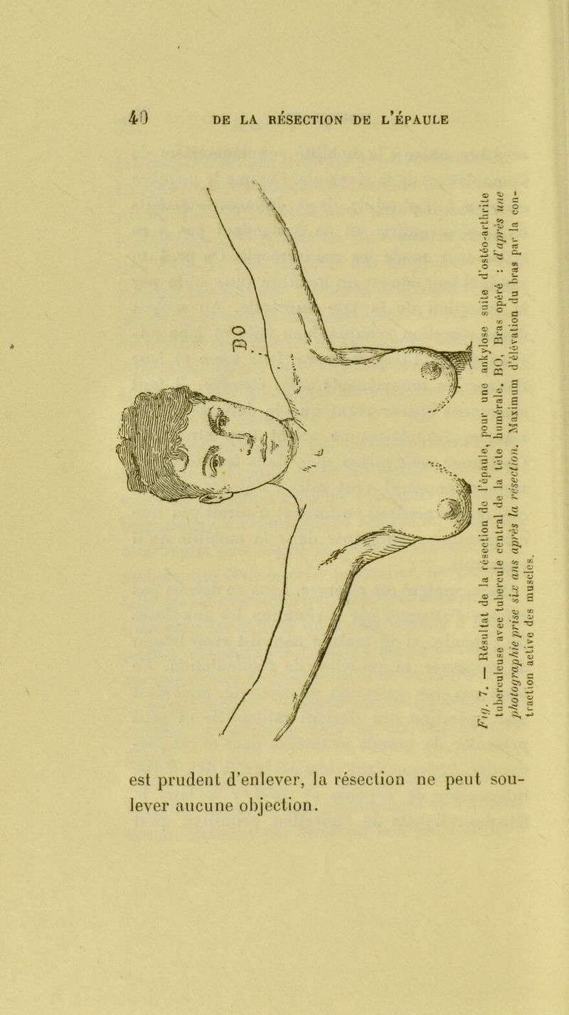O 1 g •«* ô V cS ea • O CS O eu. (A en cB *o <£> 3 *<1) • ^ eu CA O C CA O (D CS CA cB •3 d <> 5 œ O • 3 c O 3 CB S L. , •O X g c es O Vs^ , <» O O •3 fiS •J c- k) -z> _eS SJ ü p»«.i CS U. «O O 'S-' C ?N. O O «U V BJ « CA 'ZJ O g 3 a D cy S 3 Uj O 3 s> rs “5 •««» c zo — es w CJ CJ n'i'c dus 3 > cS S5. 0 CA O QJ CA 3 1 3 e 1 g c y ÏT5 0 b. CJ ® .Z « J2 2 « 3 «-> ^ — k est prudent d’enlever, la résection ne peut sou- lever aucune objection.