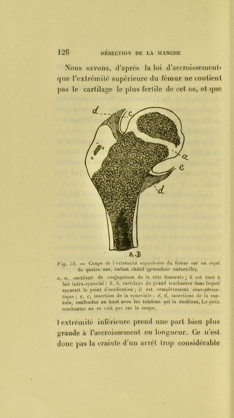 Nous savons, d’après la loi d’accroisscinenl» que l’oxtrcmilé supérieure du fémur ne contient pas le cartilage le plus fertile de cet os, et que Fuj. î)2. — Coujie »lo rexlréiiiilé sii|ioritMiro du fémur sur im sujet de quatre ans, enfant elicllf (grandeur naturelle). <(, a, raitila^e de eonju^'aisen de la tète fémorale; il est tout à fait intra-synovial : b, b, cartilage du grand trochanter dans lequel apparaît le point d'ossification ; il est complètement sous-périos- licjue ; C, c, insertion de la synoviale ; d, d, insertions de la cap- sule, confondue en haut avec les tendons qui la doublent. Le petit trochanter no se voit pas sur la coupe. 1 extrémité inférieure prend une part hien plus grande à l’accroissement en longueur. Ce n’est donc pas la crainte d’un arrêt troj) considérable