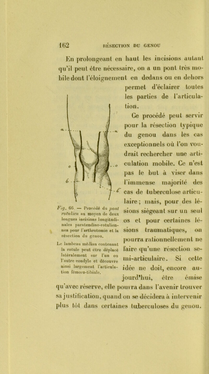 ce - . En prolongeanl en haut les incisions autant qu’il peut être nécessaire, on a un pont très mo- bile dont l’éloignement en dedans ou en dehors permet d’éclairer toutes les parties de l’articula- tion. Ce procédé peut servir pour la résection typique du genou dans les cas exceptionnels où l’on vou- drait rechercher une arti- .o culation mobile. Ce n’est pas le but à viser dans l’immense majorité des cas de tuberculose articu- laire; mais, pour des lé- sions siégeant sur un seul os et pour certaines lé- sions traumatiques, on }K)urra rationnellement ne faire qu’une résection se- mi-articulaire. Si cette idée ne doit, encore au- jourd’hui, être émise qu’avec réserve, elle pourra dans l’avenir trouver sa justitication, quand on se décidera à intervenir plus lot dans certaines tuberculoses du genou. F\çj. 66, — Prof.éilé du ‘pont rotiiUen au moyen de deux lonc:ues incisions longitudi- nales paralendino-rotulien- nes jiour l’arllirolomic et la icseclion du f;enou. Le lambeau médian contenant la rotule peut être déplacé latéralement sur l’un ou l’autre condyle et découvre ainsi largement l’articula- tion fémoro-tibiale.