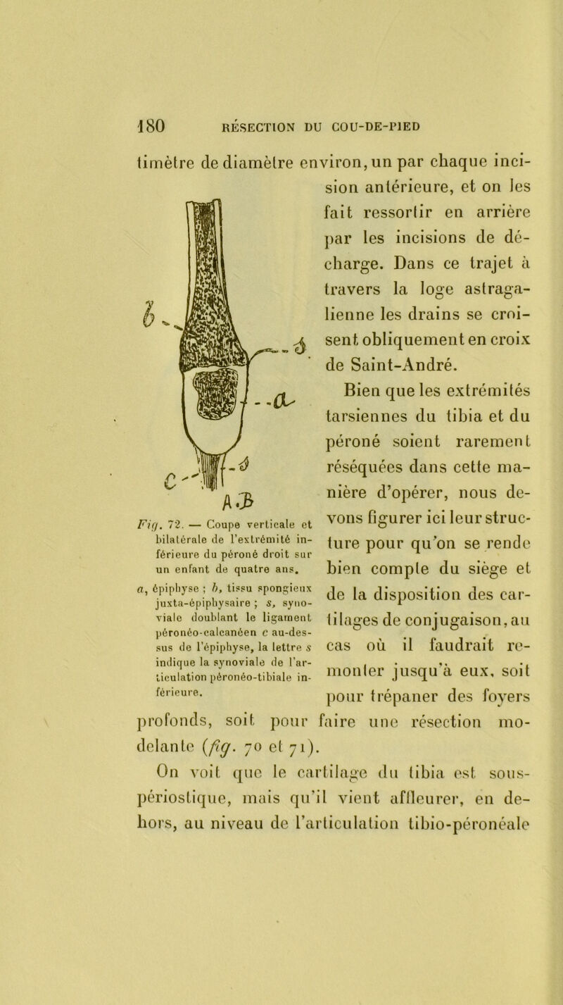 - ' limèlre de diamèlre environ, un par chaque inci- sion antérieure, et on les fait ressorlir en arrière j)ar les incisions de dé- charge. Dans ce trajet à travers la loge astraga- lienne les drains se croi- sent obliquement en croix de Saint-André. Bien que les extrémités tarsiennes du tibia et du péroné soient rarement réséquées dans cette ma- nière d’opérer, nous de- vons figurer ici leur struc- ture pour qu’on se rende bien compte du siège et de la disposition des car- tilages de conjugaison, au cas où il faudrait re- monter jusqu'à eux, soit ])Our trépaner des foyers profonds, soit pour faire une résection mo- delante {ftg. 70 et 71). On voit que le cartilage du tibia est sous- périostique, mais qu’il vient aftleurei’, en de- hors, au niveau de l’articulation tibio-péronéale Fig. 72. — Coupe verticale et bilatérale de l’extrémité in- férieure du péroné droit sur un enfant de quatre ans. fl, épiphyse ; />, tissu spongieux juxta-épiphysaire ; s. syno- viale doublant le ligament péronéo-calcanéen c au-des- sus de l’épiphyse, la lettre s indique la synoviale de l’ar- ticulation péronéo-tibiale in- férieure.