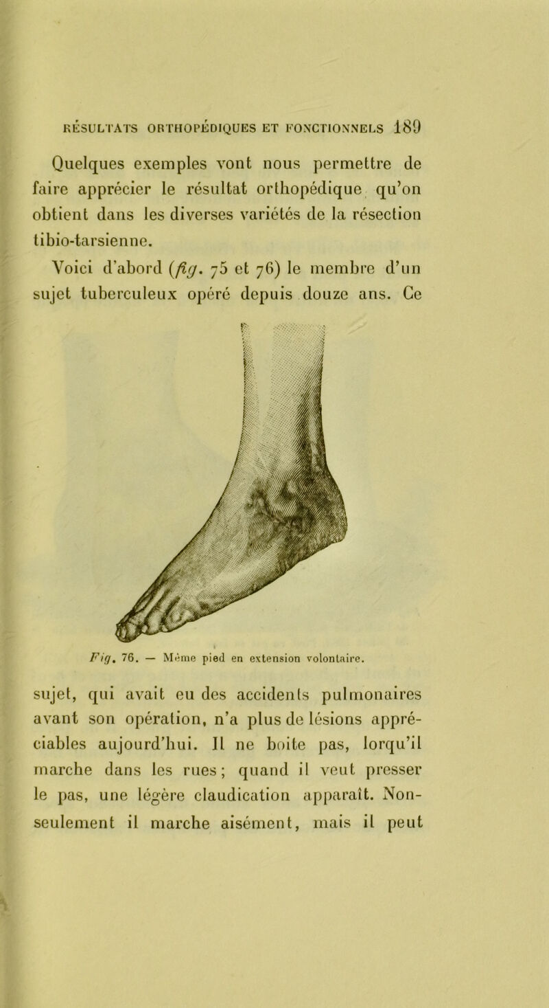 Quelques exemples vont nous permettre de faire apprécier le résultat orthopédique qu’on obtient dans les diverses variétés de la résection tibio-tarsienne. Voici d’abord {fig. /5 et 76) le membre d’un sujet tuberculeux opéré depuis douze ans. Ce P; Fig, 76. — Même pied en extension volontaire. sujet, qui avait eu des accidents pulmonaires avant son opération, n’a plus de lésions appré- ciables aujourd’hui. Il ne boite pas, lorqu’il marche dans les rues; quand il veut presser le pas, une légère claudication apparaît. Non- seulement il marche aisément, mais il peut