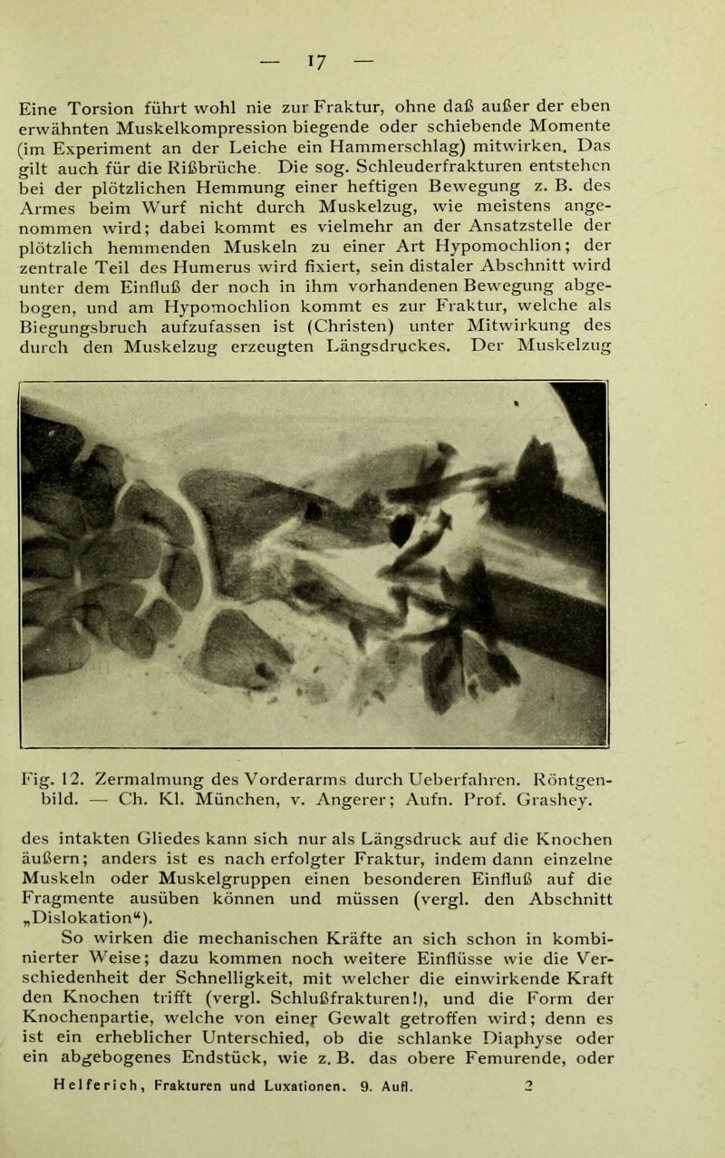 Eine Torsion führt wohl nie zur Fraktur, ohne daß außer der eben erwähnten Muskelkompression biegende oder schiebende Momente (im Experiment an der Leiche ein Hammerschlag) mitwirken. Das gilt auch für die Rißbrüche Die sog. Schleuderfrakturen entstehen hei der plötzlichen Hemmung einer heftigen Bewegung z. B. des Armes beim Wurf nicht durch Muskelzug, wie meistens ange- nommen wird; dabei kommt es vielmehr an der Ansatzstelle der plötzlich hemmenden Muskeln zu einer Art Hypomochlion; der zentrale Teil des Humerus wird fixiert, sein distaler Abschnitt wird unter dem Einfluß der noch in ihm vorhandenen Bewegung abge- bogen, und am Hypomochlion kommt es zur Fraktur, welche als Biegungsbruch aufzufassen ist (Christen) unter Mitwirkung des durch den Muskelzug erzeugten Längsdruckes. Der Muskelzug Fig. 12. Zermalmung des Vorderarms durch Ueberfahren. Röntgen- bild. — Ch. Kl. München, v. Angerer; Aufn. Prof. Grashey. des intakten Gliedes kann sich nur als Längsdruck auf die Knochen äußern; anders ist es nach erfolgter Fraktur, indem dann einzelne Muskeln oder Muskelgruppen einen besonderen Einfluß auf die Fragmente ausüben können und müssen (vergl. den Abschnitt „Dislokation“). So wirken die mechanischen Kräfte an sich schon in kombi- nierter Weise; dazu kommen noch weitere Einflüsse wie die Ver- schiedenheit der Schnelligkeit, mit welcher die einwirkende Kraft den Knochen trifft (vergl. Schlußfrakturen!), und die Form der Knochenpartie, welche von einer Gewalt getroffen wird; denn es ist ein erheblicher Unterschied, ob die schlanke Diaphyse oder ein abgebogenes Endstück, wie z. B. das obere Femurende, oder Helferich, Frakturen und Luxationen. 9. Auf]. 2