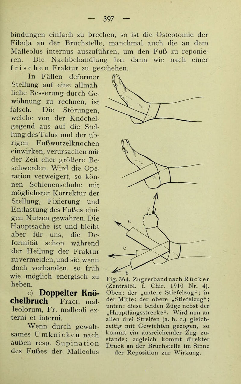 39 7 bindungen einfach zu brechen, so ist die Osteotomie der Fibula an der Bruchstelle, manchmal auch die an dem Malleolus internus auszuführen, um den Fuß zu reponie- ren. Die Nachbehandlung hat dann wie nach einer frischen Fraktur zu geschehen. In Fällen deformer Stellung auf eine allmäh- liche Besserung durch Ge- wöhnung zu rechnen, ist falsch. Die Störungen, welche von der Knöchel- gegend aus auf die Stel- lung desTalus und der üb- rigen Fuß wurzelknochen einwirken, verursachen mit der Zeit eher größere Be- schwerden. Wird die Ope- ration verweigert, so kön- nen Schienenschuhe mit möglichster Korrektur der Stellung, Fixierung und Entlastung des Fußes eini- gen Nutzen gewähren. Die Hauptsache ist und bleibt aber für uns, die De- formität schon während der Heilung der Fraktur zu vermeiden, und sie, wenn doch vorhanden, so früh wie möglich energisch zu heben. c) Doppelter Knö- chelbruch Fract. mal leolorum, Fr. malleoli ex- terni et interni. Wenn durch gewalt- sames Umknicken nach außen resp. Supination des Fußes der Malleolus v z (Zentralbl. f. Chir. 1910 Nr. 4). Oben: der „untere Stiefelzug“; in der Mitte: der obere „Stiefelzug“; unten: diese beiden Züge nebst der „Hauptlängsstrecke“. Wird nun an allen drei Streifen (a. b. c.) gleich- zeitig mit Gewichten gezogen, so kommt ein ausreichender Zug zu- stande ; zugleich kommt direkter Druck an der Bruchstelle im Sinne der Reposition zur Wirkung.