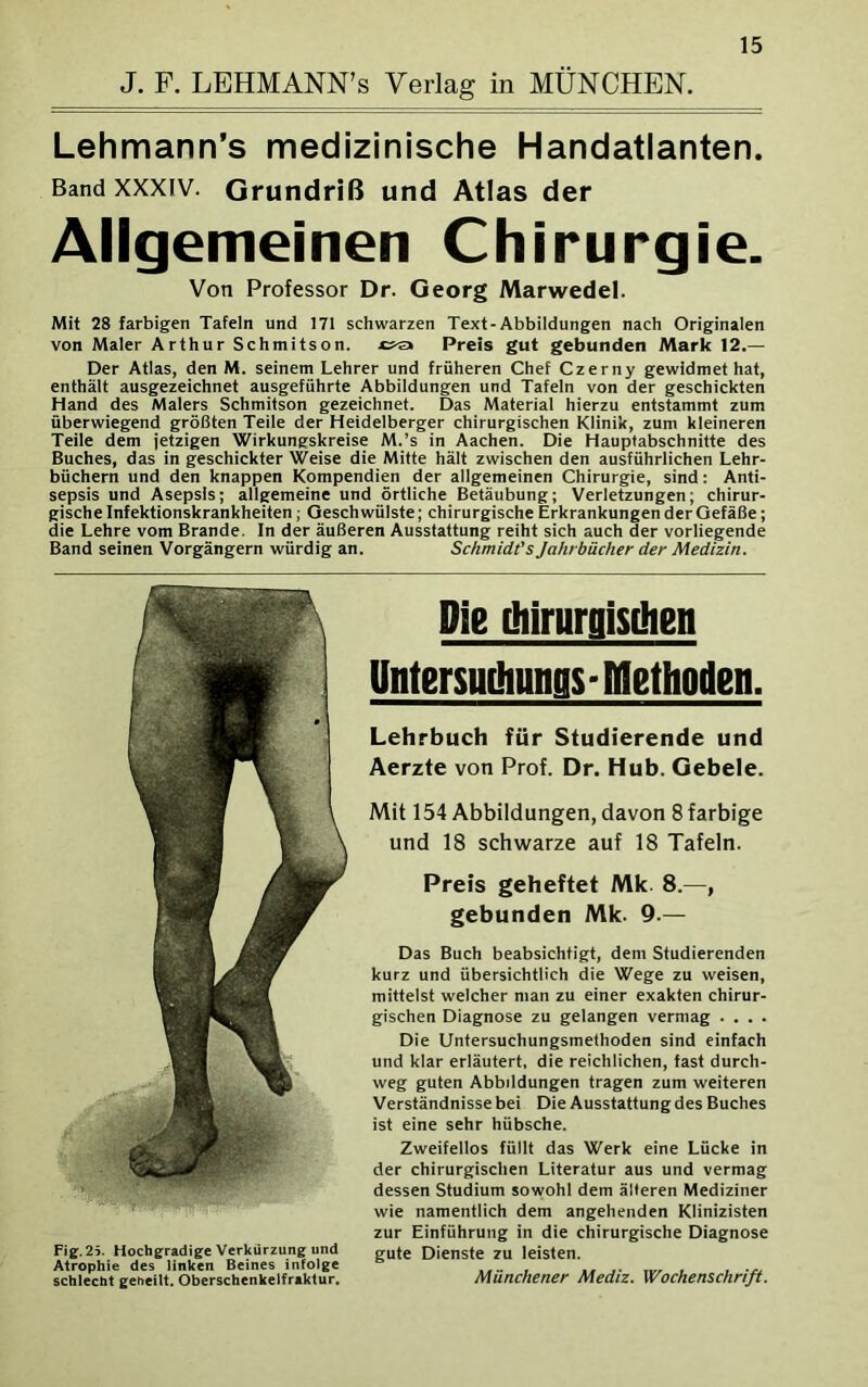 J. F. LEHMANN’s Verlag in MÜNCHEN. Lehmann’s medizinische Handatlanten. Band xxxiv. Grundriß und Atlas der Allgemeinen Chirurgie. Von Professor Dr. Georg Marwedel. Mit 28 farbigen Tafeln und 171 schwarzen Text-Abbildungen nach Originalen von Maler Arthur Schmitson. Preis gut gebunden Mark 12.— Der Atlas, den M. seinem Lehrer und früheren Chef Czerny gewidmet hat, enthält ausgezeichnet ausgeführte Abbildungen und Tafeln von der geschickten Hand des Malers Schmitson gezeichnet. Das Material hierzu entstammt zum überwiegend größten Teile der Heidelberger chirurgischen Klinik, zum kleineren Teile dem jetzigen Wirkungskreise M.’s in Aachen. Die Hauptabschnitte des Buches, das in geschickter Weise die Mitte hält zwischen den ausführlichen Lehr- büchern und den knappen Kompendien der allgemeinen Chirurgie, sind: Anti- sepsis und Asepsis; allgemeine und örtliche Betäubung; Verletzungen; chirur- gische Infektionskrankheiten ; Geschwülste; chirurgische Erkrankungen der Gefäße; die Lehre vom Brande. In der äußeren Ausstattung reiht sich auch der vorliegende Band seinen Vorgängern würdig an. Schmidt's Jahrbücher der Medizin. Fig. 2i. Hochgradige Verkürzung und Atrophie des linken Beines infolge schlecht geheilt. Oberschenkelfraktur. Pie diiriirnisihen Untersuihimas-Methoden. Lehrbuch für Studierende und Aerzte von Prof. Dr. Hub. Gebele. Mit 154 Abbildungen, davon 8 farbige und 18 schwarze auf 18 Tafeln. Preis geheftet Mk. 8.—, gebunden Mk. 9.— Das Buch beabsichtigt, dem Studierenden kurz und übersichtlich die Wege zu weisen, mittelst welcher man zu einer exakten chirur- gischen Diagnose zu gelangen vermag .... Die Untersuchungsmethoden sind einfach und klar erläutert, die reichlichen, fast durch- weg guten Abbildungen tragen zum weiteren Verständnisse bei Die Ausstattung des Buches ist eine sehr hübsche. Zweifellos füllt das Werk eine Lücke in der chirurgischen Literatur aus und vermag dessen Studium sowohl dem älteren Mediziner wie namentlich dem angehenden Klinizisten zur Einführung in die chirurgische Diagnose gute Dienste zu leisten. Münchener Mediz. Wochenschrift.