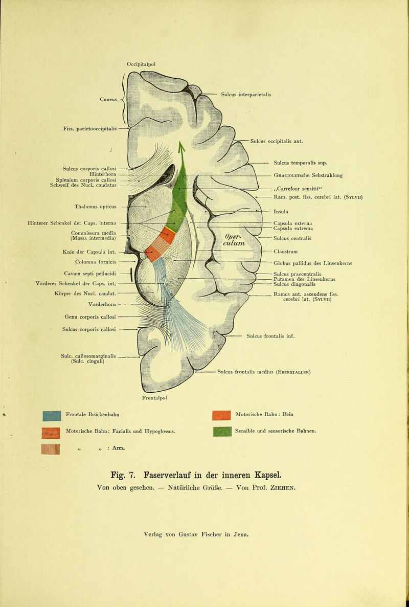 Occipitalpol Cuneus Sulcus interparietalis Sulc. callosomarginalis (Sulc. cinguli) Sulcus frontalis medius (Eberstallkr) Fiss. parietooccipitalis Sulcus corporis callosi Hinterhorn Splenium corporis callosi Schweif des Nucl. caudatus Thalamus opticus Hinterer Schenkel der Caps, interna Commissura media (Massa intermedia) Knie der Capsula int. Columna fornicis Cavum septi pellucidi Vorderer Schenkel der Caps. int. Körper des Nucl. caudat. Vorderhorn Genu corporis callosi Sulcus corporis callosi I Sulcus occipitalis ant. Sulcus temporalis sup. GRATiOLETsche Sehstrahlung ,,Carrefour sensitif“ Ram. post. fiss. cerebri lat. (Sylvii) Insula Capsula externa Capsula extrema Sulcus centralis Claustrum Globus pallidus des Linsenkerns Sulcus praecentralis Putamen des Linsenkerns Sulcus diagonalis Ramus ant. ascendens fiss. cerebri lat. (Sylvii) Sulcus frontalis inf. Frontalpol Frontale Brückenbahn SU Motorische Bahn: Facialis und Hypoglossus. m : Arm. Motorische Bahn: Bein Sensible und sensorische Bahnen. Fig. 7. Faserverlauf in der inneren Kapsel. Von oben gesehen. — Natürliche Größe. — Von Prof. Ziehen.