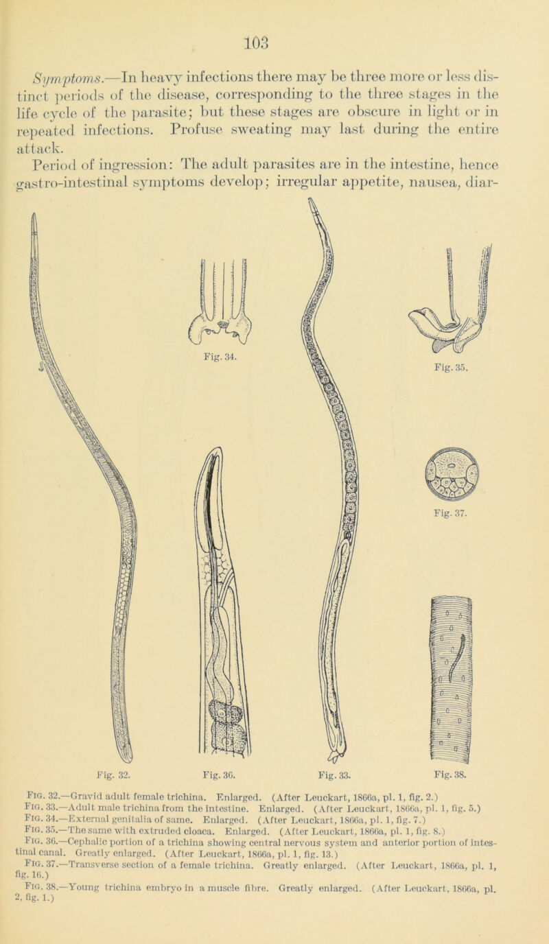 Symptoms.—In heavy infections there may be three more or less dis- tinct periods of the disease, corresponding to the three stages in the life cycle of the parasite; but these stages are obscure in light or in repeated infections. Profuse sweating may last during the entire attack. Period of digression: The adult parasites are in the intestine, hence gastro-intestinal symptoms develop; irregular appetite, nausea, diar- Fig. 30. Fig. 33. Fig. 37. Fig. 38. Fig. 32.—Gravid adult female trichina. F.nlarged. (After Leuckart, 1806a, pi. 1, fig. 2.) Fig. 33.—Adult male trichina from the intestine. Enlarged. (After Leuckart, 1800a, pi. 1, fig. 5.) Fig. 34.—External genitalia of same. Enlarged. (After Leuckart, 1800a, pi. 1, fig. 7.) Fig. 35.—Thesamc with extruded cloaca. Enlarged. (After Leuckart, 1806a, pi. 1, fig. 8.) Fig. 30.—Cephalic portion of a trichina showing central nervous system and anterior portion of intes- tinal canal. Greatly enlarged. (After Leuckart, 1806a, pi. 1, fig. 13.) Fig. 37.—Transverse section of a female trichina. Greatly enlarged. (After Leuckart, 1866a, pi. 1, fig-10.) Fig. 38.—Young trichina embryo in a muscle fibre. Greatly enlarged. (After Leuckart, 1866a, pi. 2, fig. 1.)