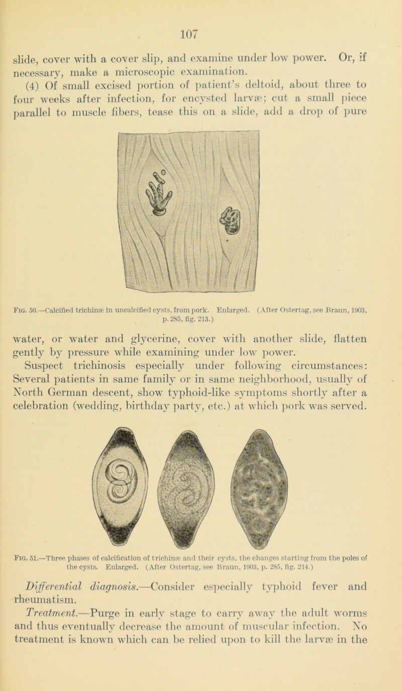 slide, cover with a cover slip, and examine under low power. Or, if necessary, make a microscopic examination. (4) Of small excised portion of patient’s deltoid, about three to four weeks after infection, for encysted larvae; cut a small piece parallel to muscle fibers, tease this on a slide, add a drop of pure Fig. 50.—Calcified trichinae in uncalcified cysts, from pork. Enlarged. (After Ostertag, see Braun, 1903, p. 2S5, fig. 213.) water, or water and glycerine, cover with another slide, flatten gently by pressure while examining under low power. Suspect trichinosis especially under following circumstances: Several patients in same family or in same neighborhood, usually of North German descent, show tvphoid-like symptoms shortly after a celebration (wedding, birthday party, etc.) at which pork was served. Fig. 51.—Three phases of calcification of trichinae and their cysts, the changes starting from the poles of the cysts. Enlarged. (After Ostertag, see Braun, 1903, p. 285, fig. 214.) Differential diagnosis.—Consider especially typhoid fever and rheumatism. Treatment.—Purge in early stage to carry away the adult worms and thus eventually decrease the amount of muscular infection. No treatment is known which can be relied upon to kill the larvse in the