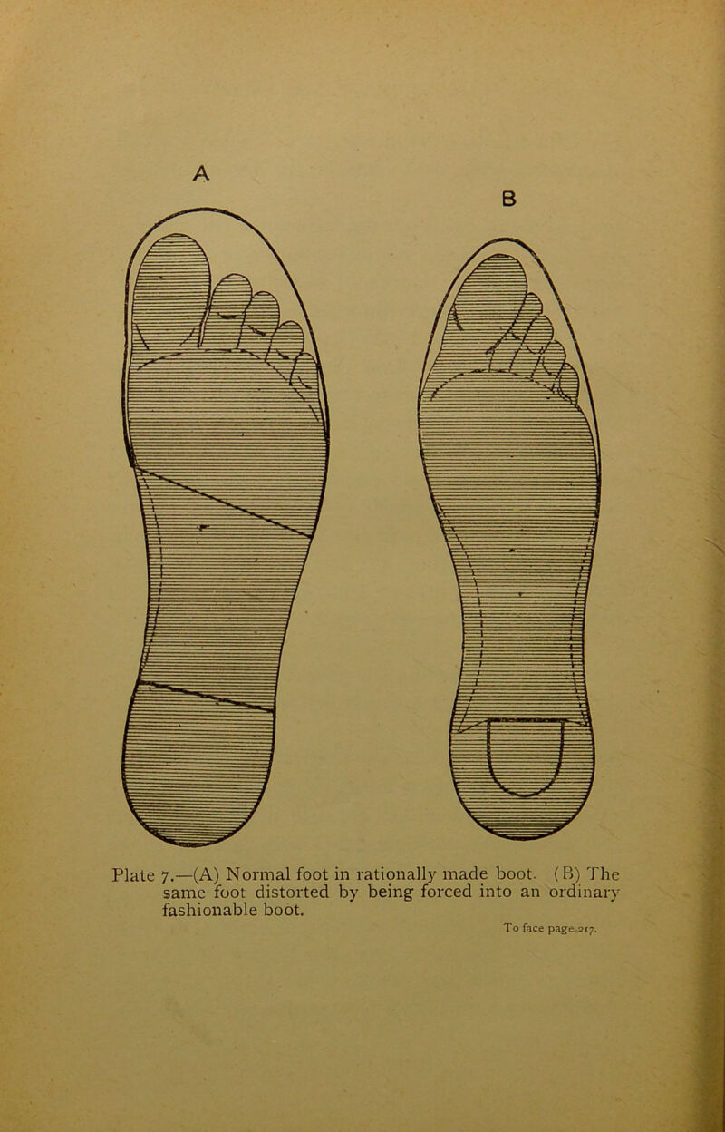 Plate 7.—(A) Normal foot in rationally made boot. (B) The same foot distorted by being forced into an ordinary fashionable boot. To face page 217.