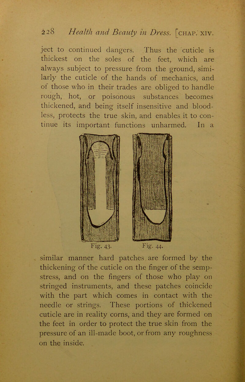 ject to continued dangers. Thus the cuticle is thickest on the soles of the feet, which are always subject to pressure from the ground, simi- larly the cuticle of the hands of mechanics, and of those who in their trades are obliged to handle rough, hot, or poisonous substances becomes thickened, and being itself insensitive and blood- less, protects the true skin, and enables it to con- tinue its important functions unharmed. In a - similar manner hard patches are formed by the thickening of the cuticle on the finger of the semp- stress, and on the fingers of those who play on stringed instruments, and these patches coincide with the part which comes in contact with the needle or strings. These portions of thickened cuticle are in reality corns, and they are formed on the feet in order to protect the true skin from the pressure of an ill-made boot, or from any roughness on the inside.