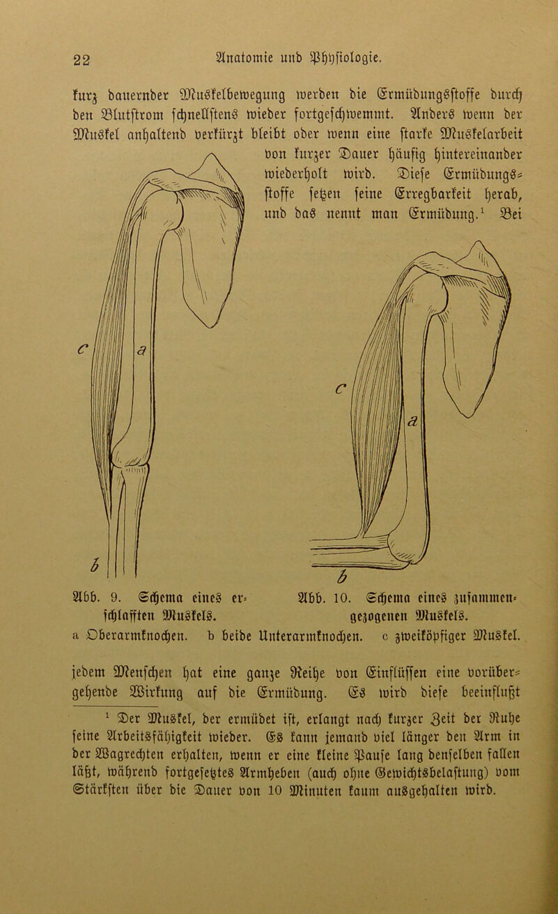 furg bauernber SJtuSfelbewegung werben bie (Srmübungöftoffe burdj bett 23tutftroni fdjneflften§ wieber fortgefcffwemmt. Slnberö Wenn ber SJhtdfel antfaltenb berfitrgt bleibt ober wenn eine ftarfe SD^uSfetarbeit bon furger Sauer tjäuftg f)intereinanber wieberl)ott wirb. Siefe (SrtnübungS* ftoffe jetten feine (Srregbarfeit fyerab, unb baS nennt man (Srmiibung.1 S3ei 2lbb. 9. ©äjettta eines er» ftfjlnffteit 9flu8fcl§. 2lbb. 10. (&d)ema eines jitfammen» gejngctten 9JluSfciS. a Dberarntfnodjen. b betbe Uuterarinfnodfen. c gweiföüftger iDtugfel. febem üDtenfdjett t)at eine gange Steife bon ©inftüffen eine borüber* getjenbe Sßirfung auf bie ©rmitbung. ($3 wirb biefe beeinflußt 1 Ser 5Dtu§fel, ber ermübet ift, erlangt uadj furger 3eit ber Stube feine 2trbeit§fät)igfett wieber. @§ tarnt jemaitb biel länger beit 2lrm in ber 2Bagred)ten erhalten. Wenn er eine fleine Sßaufe lang bettfelben faden läßt, wätjrenb fortgefeßteg Slrmljeben (aud) otjite ©ewidjtgbelaftung) bottt ©tärfften über bie Sauer bon 10 SJtinuteit taunt auSgetjalten wirb.