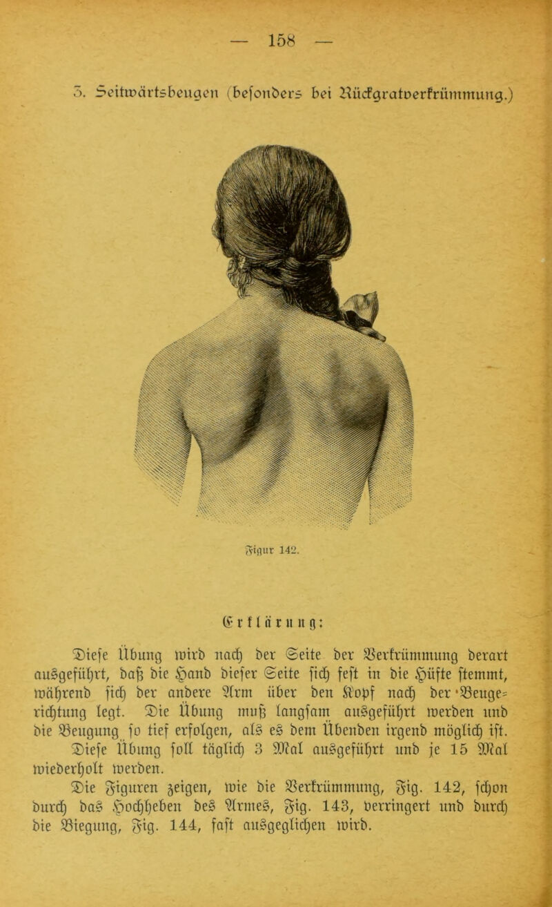 ö. Scitirärtsbcugen (bcfonbcrs bei IlücfgratDerfrümmung.) Aiflur 142. (f- r f l fl r» u n: 2)iefe ilbung inirb iiac^ ber ©eite ber ^evfrümmung berart nuSgefüljrt, baf? bte 6panb biefer ©eite fid^ feft in bie §üfte ftemmt, luä^renb fic^ ber anbere 'Slrm über ben Siopf nac^ ber ‘Seuges ric^tung legt. S)ie Übung mub langfnm au§gefü^rt werben iinb bie ©eugnng fo tief erfolgen, at§ e§ bem Übenben irgenb möglich ift. 2)iefe Übung foll tiiglid} 3 9[RnI au§gefül)rt nnb je 15 wieber^ott werben. ®ie gignren geigen, wie bie S^erfrüininung, gig. 142, fd)on burd) ba§ .'po(^t}eben be§ 9trine§, gig. 143, berringert nnb bnrd) bie ^Biegung, gig- 144, faft ausgeglichen wirb. I