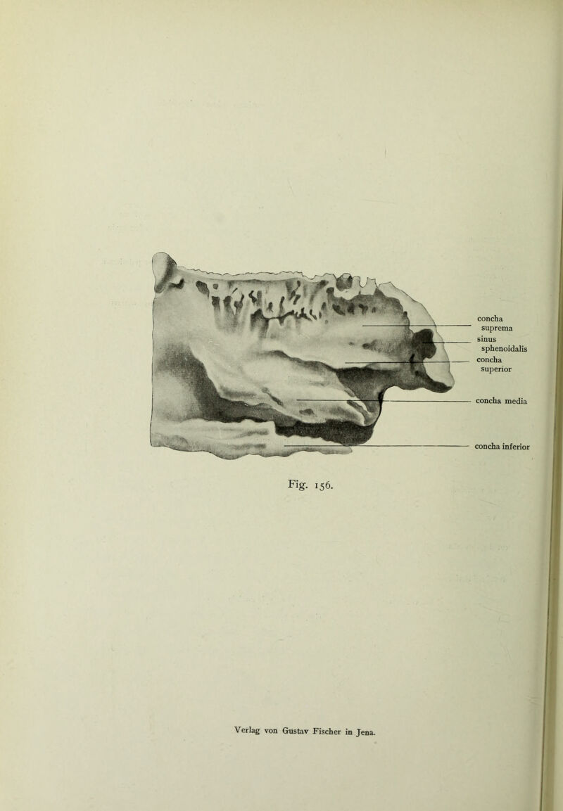 concha suprema sinus sphenoidalis concha Superior concha media concha inferior Fi g- 156. |