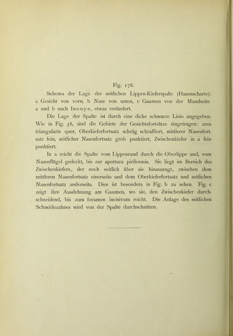 Schema der Lage der seitlichen Lippen-Kieferspalte (Hasenscharte): a Gesicht von vorn, b Nase von unten, c Gaumen von der Mundseite a und b nach Inouye, etwas verändert. Die Lage der Spalte ist durch eine dicke schwarze Linie angegeben. Wie in Fig. 38, sind die Gebiete der Gesichtsfortsätze eingetragen: area triangularis quer, Oberkieferfortsatz schräg schraffiert, mittlerer Nasenfort- satz fein, seitlicher Nasenfortsatz grob punktiert, Zwischenkiefer in a fein punktiert. In a reicht die Spalte vom Lippenrand durch die Oberlippe und, vom Nasenflügel gedeckt, bis zur apertura piriformis. Sie liegt im Bereich des Zwischenkiefers, der noch seitlich über sie hinausragt, zwischen dem mittleren Nasenfortsatz einerseits und dem Oberkieferfortsatz und seitlichen Nasenfortsatz anderseits. Dies ist besonders in Fig. b zu sehen. Fig. c zeigt ihre Ausdehnung am Gaumen, wo sie, den Zwischenkiefer durch- schneidend, bis zum foramen incisivum reicht. Die Anlage des seitlichen Schneidezahnes wird von der Spalte durchschnitten.