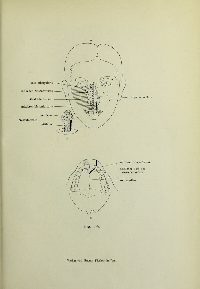 a os praemaxillare b mittlerer Nasenfortsatz seitlicher Teil des Zwischenkiefers os maxillare Fig. 178.