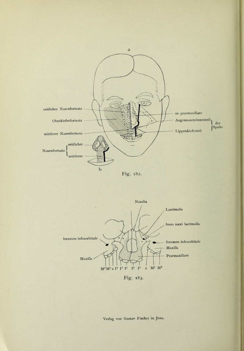 os praemaxillare Augennasenrinnenteil > [ der Lippenkieferteil b Fig. 182. Nasalia Lacrimalia fossa sacci lacrimalis foramen infraorbitale Maxilla Praemaxillare