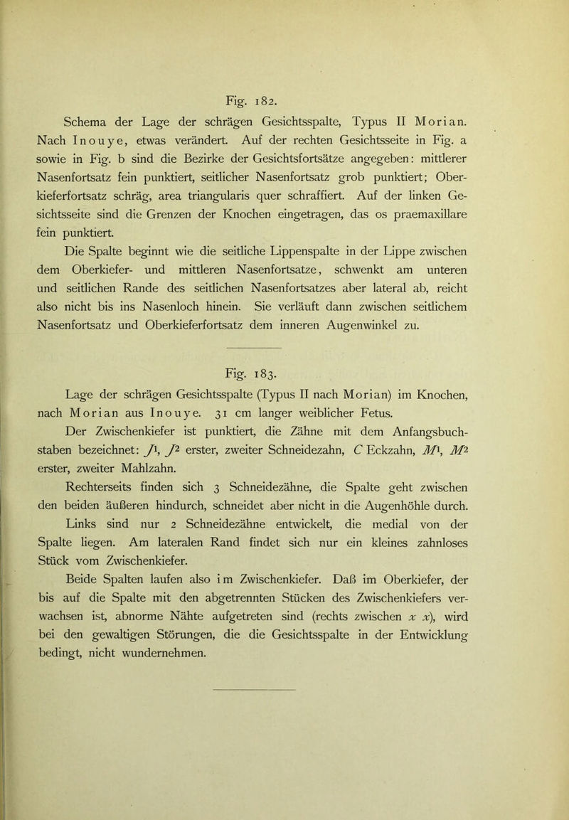 Schema der Lage der schrägen Gesichtsspalte, Typus II Morian. Nach Inouye, etwas verändert. Auf der rechten Gesichtsseite in Fig. a sowie in Fig. b sind die Bezirke der Gesichtsfortsätze angegeben: mittlerer Nasenfortsatz fein punktiert, seitlicher Nasenfortsatz grob punktiert; Ober- kieferfortsatz schräg, area triangularis quer schraffiert. Auf der linken Ge- sichtsseite sind die Grenzen der Knochen eingetragen, das os praemaxillare fein punktiert. Die Spalte beginnt wie die seitliche Lippenspalte in der Lippe zwischen dem Oberkiefer- und mittleren Nasenfortsatze, schwenkt am unteren und seitlichen Rande des seitlichen Nasenfortsatzes aber lateral ab, reicht also nicht bis ins Nasenloch hinein. Sie verläuft dann zwischen seitlichem Nasenfortsatz und Oberkieferfortsatz dem inneren Augenwinkel zu. Fig. 183. Lage der schrägen Gesichtsspalte (Typus II nach Morian) im Knochen, nach Morian aus Inouye. 31 cm langer weiblicher Fetus. Der Zwischenkiefer ist punktiert, die Zähne mit dem Anfangsbuch- staben bezeichnet: J\ J2 erster, zweiter Schneidezahn, C Eckzahn, M1, M2 erster, zweiter Mahlzahn. Rechterseits finden sich 3 Schneidezähne, die Spalte geht zwischen den beiden äußeren hindurch, schneidet aber nicht in die Augenhöhle durch. Links sind nur 2 Schneidezähne entwickelt, die medial von der Spalte liegen. Am lateralen Rand findet sich nur ein kleines zahnloses Stück vom Zwischenkiefer. Beide Spalten laufen also im Zwischenkiefer. Daß im Oberkiefer, der bis auf die Spalte mit den abgetrennten Stücken des Zwischenkiefers ver- wachsen ist, abnorme Nähte aufgetreten sind (rechts zwischen x x), wird bei den gewaltigen Störungen, die die Gesichtsspalte in der Entwicklung bedingt, nicht wundernehmen.