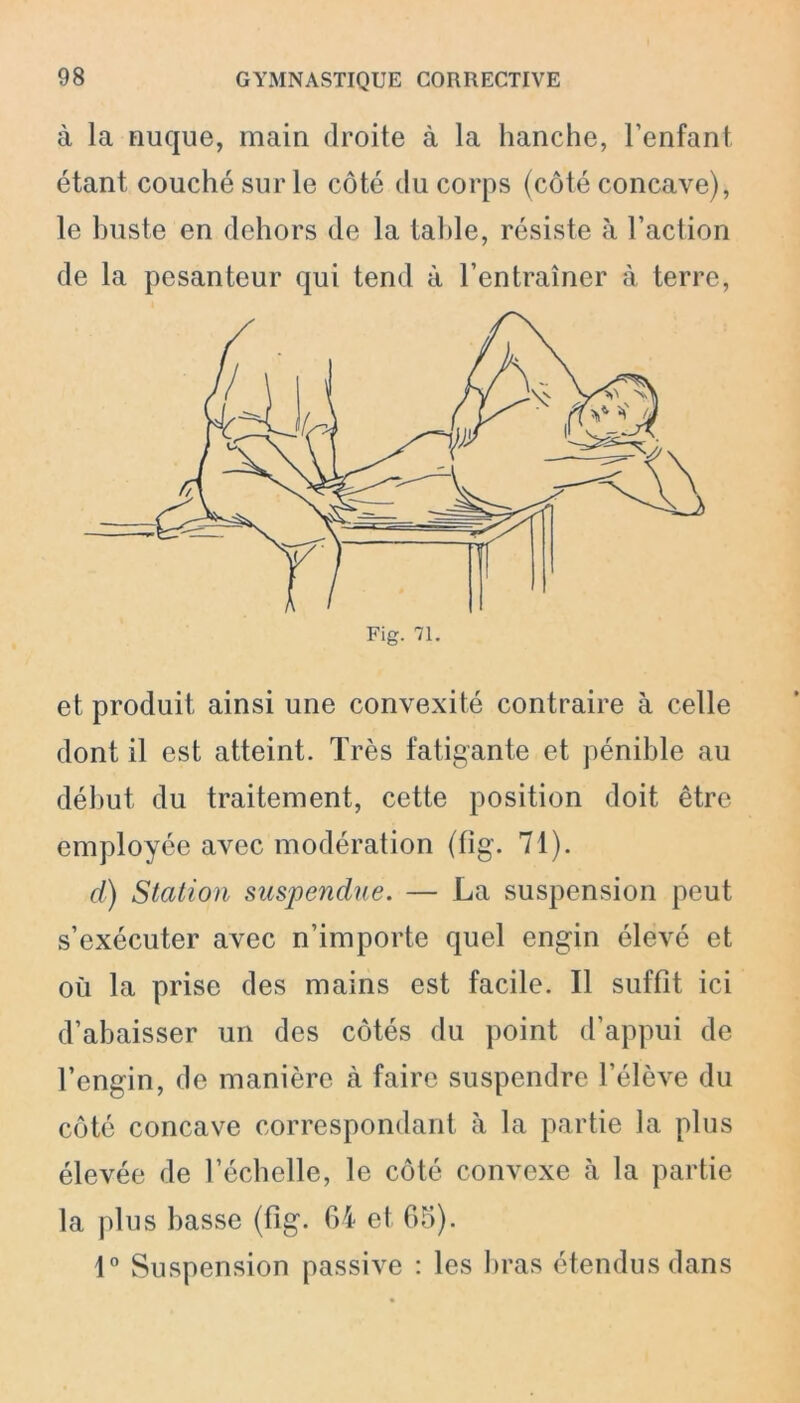 à la nuque, main droite à la hanche, l’enfant étant couché sur le côté du corps (côté concave), le buste en dehors de la table, résiste à l’action de la pesanteur qui tend à l’entraîner à terre, et produit ainsi une convexité contraire à celle dont il est atteint. Très fatigante et pénible au début du traitement, cette position doit être employée avec modération (fig. 71). d) Station suspendue. — La suspension peut s’exécuter avec n’importe quel engin élevé et où la prise des mains est facile. Il suffît ici d’abaisser un des côtés du point d’appui de l’engin, de manière à faire suspendre l’élève du côté concave correspondant à la partie la plus élevée de l’échelle, le côté convexe h la partie la plus basse (fig. 64 et 65). 1° Suspension passive : les bras étendus dans