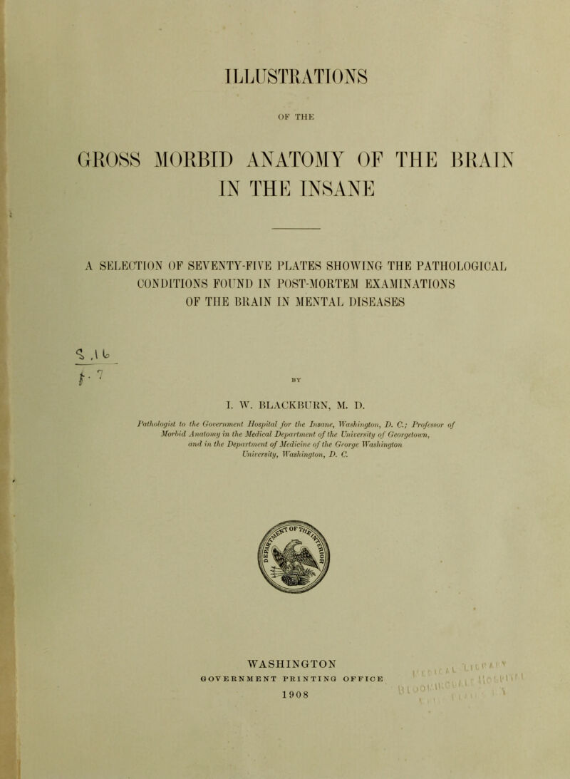 ILLUSTRATIONS OF THE GROSS MORBID ANATOMY OF THE DRAIN IN THE INSANE A SELECTION OF SEVENTY-FIVE PLATES SHOWING THE PATHOLOGICAL CONDITIONS FOUND IN POST-MORTEM EXAMINATIONS OF THE BRAIN IN MENTAL DISEASES ,1 U I. W. BLACKBURN, M. D. Pathologist to the Government Hospital for the Insane, Washington, D. C.; Professor of Morbid A natomy in the Medical Department of the University of Georgetown, and in the Department of Medicine of the George Washington University, Washington, D. C. \ WASHINGTON GOVERNMENT PRINTING OFFICE 1908