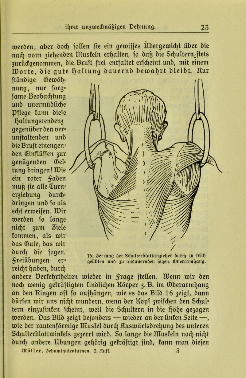 merben, aber bod) follen fie ein gemiffes Übergecoidjt über bie nad) oorn 3ief)enben ITtusfeln erhalten, fo ba§ bie Sd)ulternjtets 3urüdgenommen, bie, Bruft frei entfaltet erfdjeint unb, mit einem IDorte, bie gute Haltung bauernb bemaljrt bleibt. Hur ftänbige (Bemöl)1 nung, nur forgs fame Beobachtung unb unermüblidje Pflege fann biefe fjaltungstenben3 gegenüber ben t>er= unftaltenben unb bie Bruft einengem ben (Hnflüffen 3ur genügenben (Beb tung bringen! IDie ein roter $aben mufj fie alle üurm er3iet)ung burd)= bringen unb fo als ed)t erroeifen. tüir roerben fo lange nict)t 3um Siele fommen, als mir bas (Bute, bas mir burch bie fogen. 5reiübungen er= reicht haben, öurch anbere Derfehrtheiten mieber in 5ra9e ftcllen. tDenn mir ben noch menig geträftigten finblid)en Körper 3. B. im ©fterarmhang an ben Hingen oft fo aufhängen, mie es bas Bilb 16 3eigt, bann bürfen mir uns nicht munbern, menn ber Kopf 3mifcf)en ben Schub tern ein3ufinfen fdjeint, meil bie Schultern in bie f)öf)e ge3ogen merben. Bas Bilb 3eigt befonbers — mieber an ber Unten Seite —, mie ber rautenförmige HTusfel burd) Husmärtsbrefjung bes unteren Scf)ulterblattminfels ge3errt mirb. $0 lange bie HTusfeln nod) nid)t burd) anbere Übungen gehörig geträftigt firtb, fann man biefen TTTöIIer, 3el)nmtnutcnturnen. 2. flufl. 3 16. 3errung ber Sd)ulterblattan3iet)er burd) 3U frül) geübten utib 3U anbauernben fogen. ©berarmfjang.