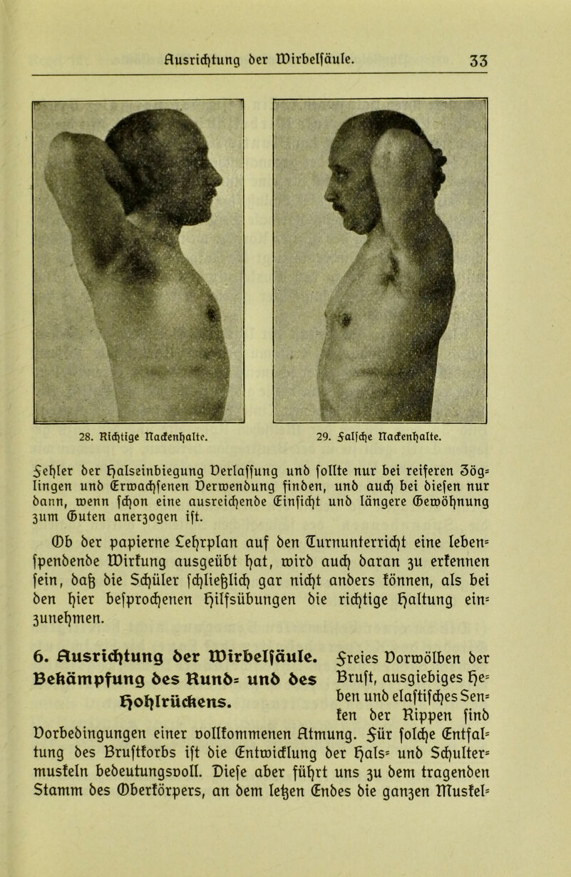 28. Richtige nadenljalte. 29. Salfdje Racfenljaltc. Segler ber Ejalseinbiegung Derlaffung unb follte nur bei reiferen 3ög= Iingen unb (Ertoachfenen Dertoenbung finben, unb aud) bei biefen nur bann, toenn fcf)on eine ausreid)enbe (Einficht unb längere ©etoöhnung 311m (Buten anerjogen ift. ©b ber papierne £ef)rplan auf bert {Turnunterricht eine leben5 fpenbenbe UMrfung ausgeübt hat, roirb auch baran 3U erfennen fein, ba§ bie Schüler fchlieftlicf) gar nid)t anbers fönnen, als bei ben t}kx befproefjenen f)ilfsübungen bie richtige Haltung eins 3unehmen. 6. ftusricfytung ber tüirbelfäule. $reies öorroölben ber Bekämpfung bes Kunb= unb bes Bruft, ausgiebiges fje= Boblrüchcns. ben unb eloftifc^cs Sen- fen ber Kippen finb Dorbebingungen einer oollfommenen Atmung. $ür foldje (Entfal5 tung bes Bruftforbs ift bie (Entroicflung ber f)als= unb Schulter5 musfein bebeutungsooil. Diefe aber führt uns 3U bem tragenben Stamm bes ©berförpers, an bem le^en (Enbes bie gan3en TTTusfel5