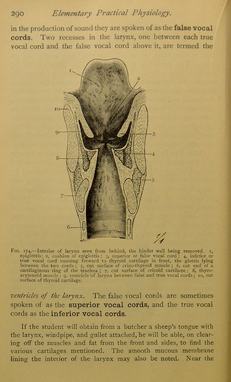 in the production of sound they are spoken of as the false vocal cords. Two recesses in the larynx, one between each true vocal cord and the false vocal cord above it, are termed the Fig. 174.—Interior of larynx seen from behind, the hinder wall being removed, i, epiglottis; 2, cushion of epiglottis; 3, superior or false vocal cord; 4, inferior or true vocal cord running forward to thyroid cartilage in front, the glottis lying between the two cords ; 5, cut surface of crico-thyroid muscle ; 6, cut end of a cartilaginous ring of the trachea ; 7, cut surface of cricoid cartilaee ; 8, thyro- arytenoid muscle ; g, ventricle‘of larynx between false and true vocal cords; 10, cut surface of thyroid cartilage. ventricles of the larynx. The false vocal cords are sometimes spoken of as the superior vocal cords, and the true vocal cords as the inferior vocal cords. If the student will obtain from a butcher a sheep’s tongue with the larynx, windpipe, and gullet attached, he will be able, on clear- ing off the muscles and fat from the front and sides, to find the various cartilages mentioned. The smooth mucous membrane lining the interior of the larynx may also be noted. Near the