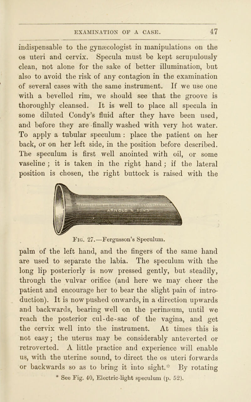 indispensable to the gynaecologist in manipulations on the os uteri and cervix. Specula must be kept scrupulously clean, not alone for the sake of better illumination, but also to avoid the risk of any contagion in the examination of several cases with the same instrument. If we use one with a bevelled rim, we should see that the groove is thoroughly cleansed. It is well to place all specula in some diluted Condy’s fluid after they have been used, and before they are finally washed with very hot water. To apply a tubular speculum : place the patient on her back, or on her left side, in the position before described. The speculum is first well anointed with oil, or some vaseline ; it is taken in the right hand; if the lateral position is chosen, the right buttock is raised with the Fig. 27.—Fergusson’s Speculum. palm of the left hand, and the fingers of the same hand are used to separate the labia. The speculum with the long lip posteriorly is now pressed gently, but steadily, through the vulvar orifice (and here we may cheer the patient and encourage her to bear the slight pain of intro- duction). It is now pushed onwards, in a direction upwards and backwards, bearing well on the perineum, until we reach the posterior cul-de-sac of the vagina, and get the cervix well into the instrument. At times this is not easy; the uterus may be considerably anteverted or retroverted. A little practice and experience will enable us, with the uterine sound, to direct the os uteri forwards or backwards so as to bring it into sight.* By rotating * See Fig. 40, Electric-light speculum (p. 52).