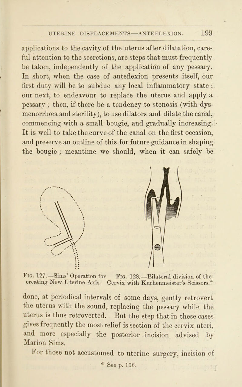 applications to the cavity of the uterus after dilatation, care- ful attention to the secretions, are steps that must frequently be taken, independently of the application of any pessary. In short, when the case of anteflexion presents itself, our first duty will be to subdue any local inflammatory state ; our next, to endeavour to replace the uterus and apply a pessary; then, if there be a tendency to stenosis (with dys- menorrhoea and sterility), to use dilators and dilate the canal, commencing with a small bougie, and gradually increasing. It is well to take the curve of the canal on the first occasion, and preserve an outline of this for future guidance in shaping the bougie; meantime we should, when it can safely be Fig. 127.—Sims’ Operation for Fig. 128.—Bilateral division of the creating New Uterine Axis. Cervix with Kuchenmeister’s Scissors.* done, at periodical intervals of some days, gently retrovert the uterus with the sound, replacing the pessary while the uterus is thus retroverted. But the step that in these cases gives frequently the most relief is section of the cervix uteri, and more especially the posterior incision advised by Marion Sims. I or those not accustomed to uterine surgery, incision of