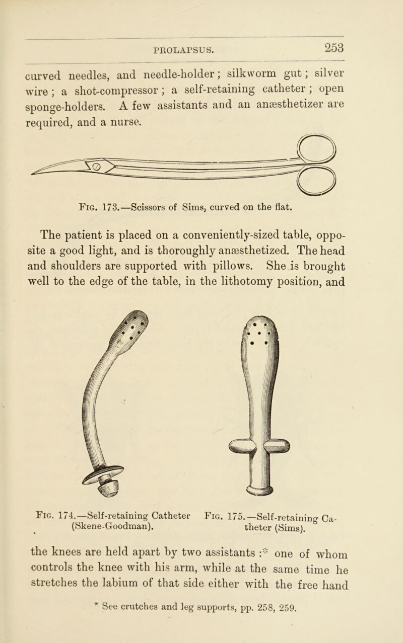 curved needles, and needle-holder; silkworm gut j silver wire ) a shot-compressor; a self-retaining catheter , open sponge-holders. A. few assistants and an anaesthetizer are required, and a nurse. The patient is placed on a conveniently-sized table, oppo- site a good light, and is thoroughly anaesthetized. The head and shoulders are supported with pillows. She is brought well to the edge of the table, in the lithotomy position, and Fig. 174.—Self-retaining Catheter Fig. 175.—Self-retaining Ca- (Skene-Goodman). theter (Sims). & the knees are held apart by two assistants :* one of whom controls the knee with his arm, while at the same time he stretches the labium of that side either with the free hand * See crutches and leg supports, pp. 258, 259.