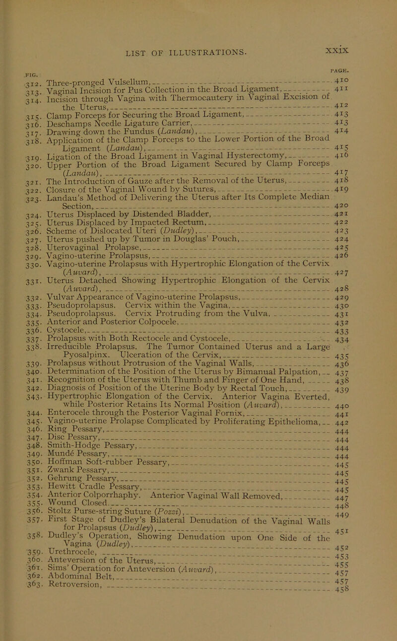 FIG. 312. 3I3- 3I4. 3X5- 316. 317- 31S. 3X9- 32°. 32r- 322. 323- 324- 325- 326. 327- 328. 329- 33°- 33x- 332- 333- 334- 335- 336. 337- 33s- 339- 340. 34x- 342. 343- 344- 345- 346. 347- 348. 349- 35°- 35x- 352. 353- 354- 355- 356. 357- 358. 359- 36°. 361. 362. 363. PAGE. Three-pronged Vulsellum, 7 4IQ Va°inal Incision for Pus Collection in the Broad Ligament, .- . 4X1 Incision through Vagina with Thermocautery in Vaginal Excision of the Uterus, 412 Clamp Forceps for Securing the Broad Ligament, 4X3 Deschamps Needle Ligature Carrier, 4X3 Drawing down the Fundus (Landau), 4I4 Application of the Clamp Forceps to the Lower Portion of the Broad Ligament {Landau), 4I5 Ligation of the Broad Ligament in Vaginal Hysterectomy, 416 Upper Portion of the Broad Ligament Secured by Clamp Forceps {Landau), 4X7 The Introduction of Gauze after the Removal of the Uterus, 418 Closure of the Vaginal Wound by Sutures, 4X9 Landau’s Method of Delivering the Uterus after Its Complete Median Section, 420 Uterus Displaced by Distended Bladder, 421 Uterus Displaced by Impacted Rectum, 422 Scheme of Dislocated Uteri {Dudley), 423 Uterus pushed up by Tumor in Douglas’ Pouch, 424 Uterovaginal Prolapse, 425 Vagino-uterine Prolapsus, 426 Vagino-uterine Prolapsus with Hypertrophic Elongation of the Cervix {Auvard), • 427 Uterus Detached Showing Hypertrophic Elongation of the Cervix {Auvard), 428 Vulvar Appearance of Vagino-uterine Prolapsus, 429 Pseudoprolapsus. Cervix within the Vagina, 430 Pseudoprolapsus. Cervix Protruding from the Vulva. 431 Anterior and Posterior Colpocele, _ 432 Cystocele, 433 Prolapsus with Both Rectocele and Cystocele, 434 Irreducible Prolapsus. The Tumor Contained Uterus and a Large Pyosalpinx. Ulceration of the Cervix, 435 Prolapsus without Protrusion of the Vaginal Walls, 436 Determination of the Position of the Uterus by Bimanual Palpation, 437 Recognition of the Uterus with Thumb and Finger of One Hand, 438 Diagnosis of Position of the Uterine Body by Rectal Touch, 439 Hypertrophic Elongation of the Cervix. Anterior Vagina Everted, while Posterior Retains Its Normal Position {Auvard), 440 Enterocele through the Posterior Vaginal Fornix, 441 Vagino-uterine Prolapse Complicated by Proliferating Epithelioma,-. 442 Ring Pessary, 444 Disc Pessary, 444 Smith-Hodge Pessary, 444 Munde Pessary, 444 Hoffman Soft-rubber Pessary, 44^ Zwank Pessary, e Gehrung Pessary, 44e Hewitt Cradle Pessary, 44e Anterior Colporrhaphy. Anterior Vaginal Wall Removed, I. 447 Wound Closed 44§ Stoltz Purse-string Suture {Pozzi), 44o First Stage of Dudley’s Bilateral Denudation of the Vaginal Walls for Prolapsus {Dudley) . _ j Dudley’s Operation, Showing Denudation upon One Side of the 4 Vagina {Dudley) __ ... Urethrocele, Ante version of the Uterus, ' Sims’ Operation for Anteversion {Auvard), II' Abdominal Belt, ' Retroversion,