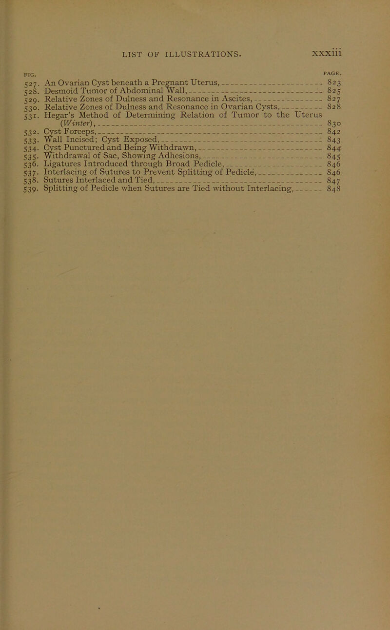 PIG. PAGE. 527. An Ovarian Cyst beneath a Pregnant Uterus, 823 528. Desmoid Tumor of Abdominal Wall, 825 529. Relative Zones of Dulness and Resonance in Ascites, S27 530. Relative Zones of Dulness and Resonance in Ovarian Cysts, 828 531. Hegar’s Method of Determining Relation of Tumor to the Uterus (Winter), 830 532. Cyst Forceps, 842 533. Wall Incised; Cyst Exposed, 843 534. Cyst Punctured and Being Withdrawn, 844 535. Withdrawal of Sac, Showing Adhesions, 845 536. Ligatures Introduced through Broad Pedicle, 846 537. Interlacing of Sutures to Prevent Splitting of Pedicle, 846 538. Sutures Interlaced and Tied, 847 539. Splitting of Pedicle when Sutures are Tied without Interlacing, 84S