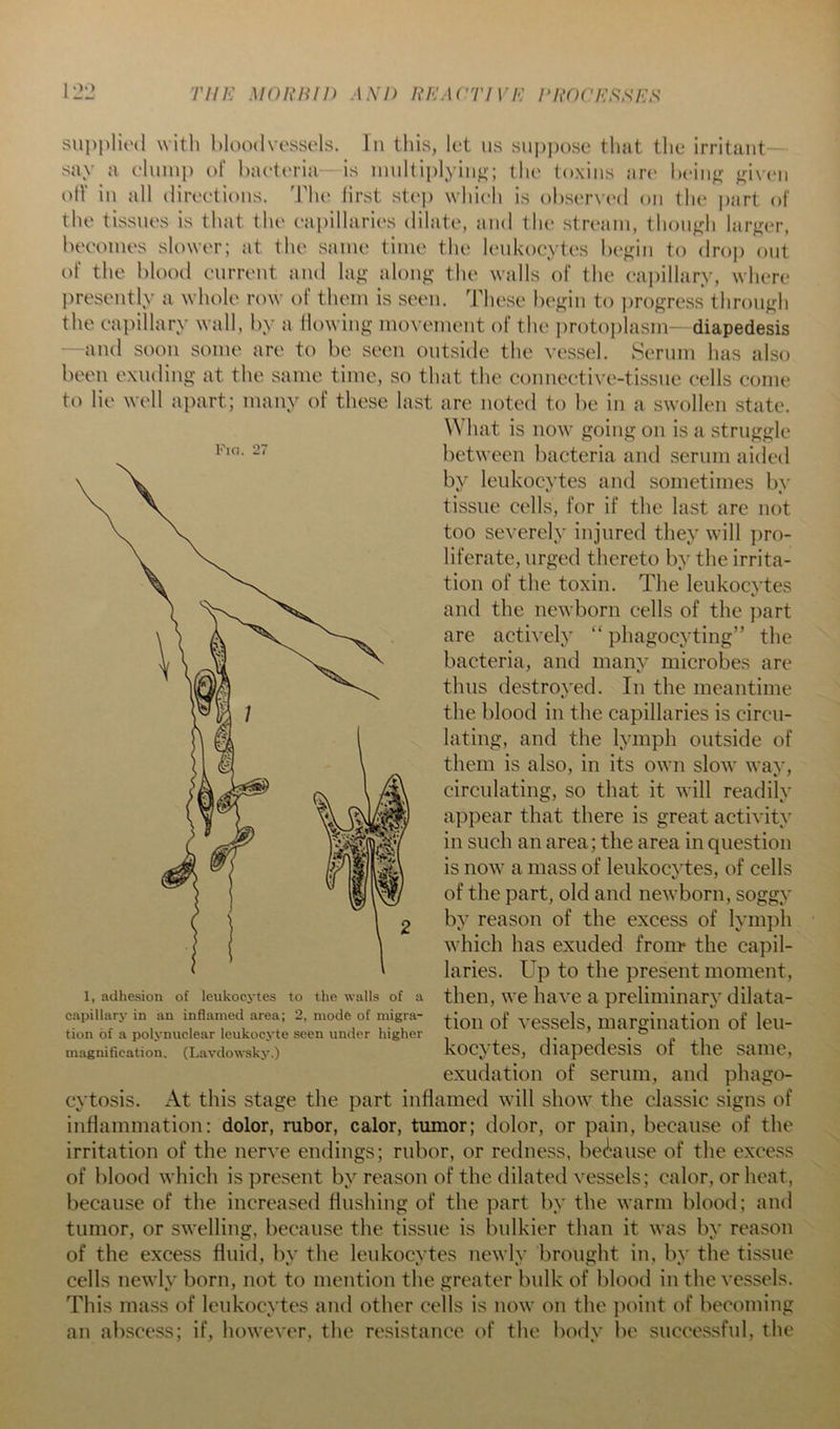 THE MOElUn AM) EEM'TIVE EEncESSES •>•) siijiplicHl witli hloodvossols. In tliis, Int us suj)i)ose tliat tlie irritant say a rluinp ol' hactoria is innltiplyino-; tlin toxins arc* hoin^^ ^^ivcn olV in all directions. The lirst step which is ohservc'd on the j)art ol' the tissues is that the eai)illaries dilate, and the stream, thouf^h lar^a*r, heeoines slower; at the same time the leukocytes he^nn to droj) out of the blood current and la^- alon^' the walls of the capillary, where l)resently a whole row of them is seen. These begin to ])rogress through the capillary wall, by a Howing movement of the i)roto])lasm—diapedesis —and soon some are to be seen outside the vessel. Serum has also been exuding at the same time, so that the conneetive-tissne cells come to lie well a])art; many of these last are noted to be in a swollen state. What is now going on is a struggle between bacteria and serum ai(led by leukocytes and sometimes by tissue cells, for if the last are not too severely injured they will ]>ro- liferate, urged thereto by the irrita- tion of the toxin. The leukocytes and the newborn cells of the ])art are actively “ phagocyting” the bacteria, and many microbes are thus destroyed. In the meantime the blood in the capillaries is circu- lating, and the lymph outside of them is also, in its own slow way, circulating, so that it will readilv appear that there is great activity in such an area; the area in question is now a mass of leukocytes, of cells of the part, old and newborn, soggy by reason of the excess of lymph which has exuded from* the capil- laries. Up to the present moment, then, we have a preliminary dilata- tion of vessels, margination of leu- kocytes, diapedesis of the same, exudation of serum, and phago- cytosis. At this stage the part inflamed will show the classic signs of inflammation: dolor, rubor, calor, tumor; dolor, or pain, because of the irritation of the nerve endings; rubor, or redness, bed*aiise of the excess of blood which is present by reason of the dilated vessels; calor, or heat, because of the increased flnshing of the part by the warm blood; and tumor, or swelling, because the tissue is bulkier than it was by reason of the excess flnid, bv the lenkoevtes newlv brought in, bv the tissue cells newly born, not to mention the greater bulk of blood in the vessels. This mass of leukocytes and other cells is now on the jioint of becoming an abscess; if, however, the resistance of the body be successful, the 1, adhesion of leukocytes to the walls of a capillary in an inflamed area; 2, mode of migra- tion of a polynuclear leukocyte seen under higher magnification. (Lavdowsky.)