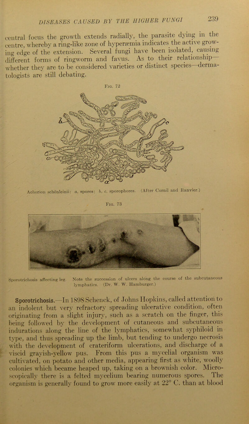 central focus the growth extends radially, the parasite dying in the centre, whereby a ring-like zone of hypersemia indicates the active grow- ing edge of the extension. Several fungi have been isolated, causing different forms of ringworm and faviis. As to their relationship whether they are to be considered varieties or distinct species derma- tologists are still debating. Fig. 72 Achorion schonleinii: a, spores; h, c, sporophores. (After Cornil and Itanvier.) Fig. 73 Sporotrichosis affecting leg. Note the succession of ulcers along the course of the subcutaneous lymphatics. (Dr. W. W. Hamburger.) Sporotrichosis.—In 1898 Schenck, of Johns Hopkins, called attention to an indolent but very refractory spreading ulcerative condition, often originating from a slight injury, such as a scratch on the finger, this being followed by the development of cutaneous and subcutaneous indurations along the line of the lymphatics, somewhat syphiloid in type, and thus spreading up the limb, but tending to undergo necrosis with the development of crateriform ulcerations, and discharge of a viscid grayish-yellow pus. From this pus a mycelial organism was cultivated, on potato and other media, appearing first as white, woolly colonies which became heaped up, taking on a brownish color. Micro- scopically there is a feltetl mycelium bearing numerous spores. The organism is generally found to grow more easily at 22° C. than at blood