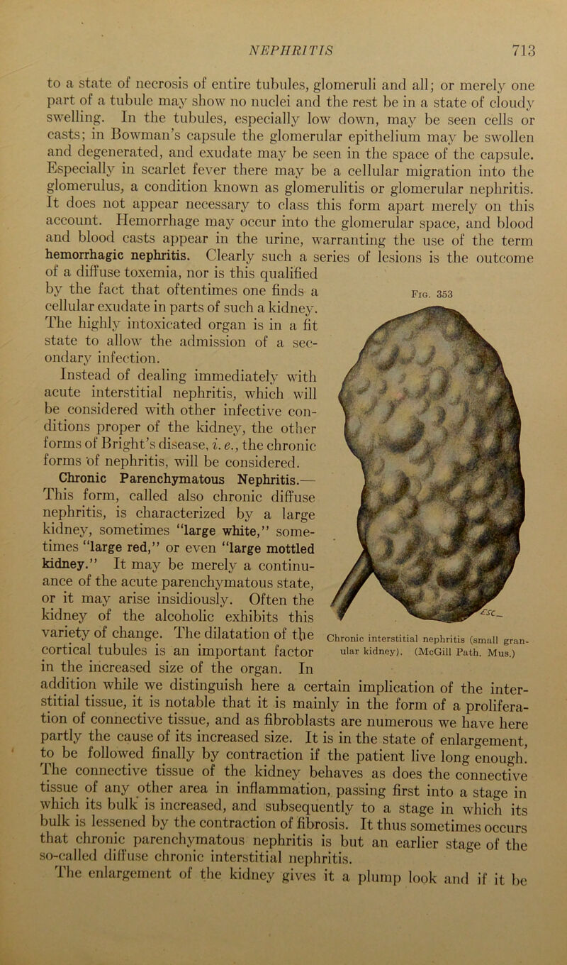 Fig. 353 to a state of necrosis of entire tubules, glomeruli and all; or merely one part of a tubule may show no nuclei and the rest be in a state of cloudy swelling. In the tubules, especially low down, may be seen cells or casts; in Bowman’s capsule the glomerular epithelium may be swollen and degenerated, and exudate may be seen in the space of the capsule. Especially in scarlet fever there may be a cellular migration into the glomerulus, a condition known as glomerulitis or glomerular nephritis. It does not appear necessary to class this form apart merely on this account. Hemorrhage may occur into the glomerular space, and blood and blood casts appear in the urine, warranting the use of the term hemorrhagic nephritis. Clearly such a series of lesions is the outcome of a diffuse toxemia, nor is this qualified by the fact that oftentimes one finds a cellular exudate in parts of such a kidney. The highly intoxicated organ is in a fit state to allow the admission of a sec- ondary^ infection. Instead of dealing immediately with acute interstitial nephritis, which will be considered with other infective con- ditions proper of the kidney, the other forms of Bright’s disease, i. e., the chronic forms of nephritis, will be considered. Chronic Parenchymatous Nephritis.— This form, called also chronic diffuse nephritis, is characterized by a large kidney, sometimes “large white,” some- times “large red,” or even “large mottled kidney.” It may be merely a continu- ance of the acute parenchymatous state, or it may arise insidiously. Often the kidney of the alcoholic exhibits this variety of change. The dilatation of tfie cortical tubules is an important factor in the increased size of the organ. In addition while we distinguish here a certain implication of the inter- stitial tissue, it^ is notable that it is mainly in the form of a prolifera- tion of connective tissue, and as fibroblasts are numerous we have here partly the cause of its increased size. It is in the state of enlargement, to be followed finally by contraction if the patient live long enough! ITe connective tissue of the kidney behaves as does the connective tissue of any other area in inflammation, passing first into a stage in which its bulk is increased, and subsequently to a stage in which its bulk is lessened by the contraction of fibrosis. It thus sometimes occurs that chronic parenchymatous nephritis is but an earlier stage of the so-called diffuse chronic interstitial nephritis. The enlargement of the kidney gives it a plump look and if it be Chronic interstitial nephritis (small gran- ular kidney). (McGill Path. Mus.)