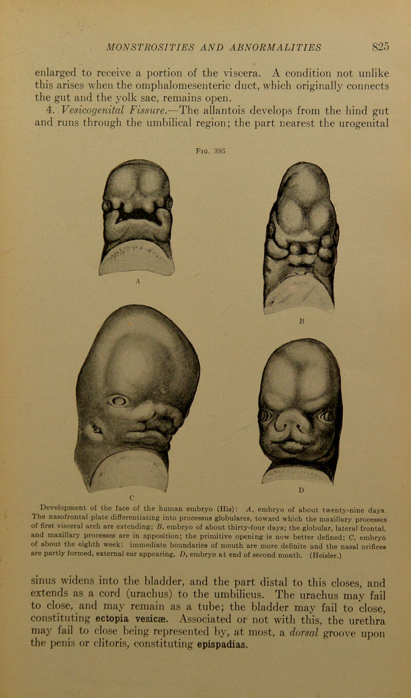 enlarged to receive a portion of the viscera. A condition not unlike this arises when the omphalomesenteric duct, which originally connects the gut and the yolk sac, remains open. 4. Vesicogenital Fissure.—The allantois develops from the hind gut and runs through the umbilical region; the part nearest the urogenital Fig. 395 Development of the face of the human embryo (His): A, embryo of about twenty-nine days. The nasofrontal plate differentiating into processus globulares, toward which the maxillary processes of first visceral arch are extending; B, embryo of about thirty-four days; the globular, lateral frontal, and maxillary processes are in apposition; the primitive opening is now better defined; C, embryo of about the eighth week: immediate boundaries of mouth are more definite and the nasal orifices are partly formed, external ear appearing, D, embryo at end of second month. (Heisler.) sinus widens into the bladder, and the part distal to this closes, and extends as a cord (urachus) to the umbilicus. The urachus may fail to close, and may remain as a tube; the bladder may fail to close, constitiiting ectopia vesicse. Associated or not with this, the urethra may fail to close being represented by, at most, a dorsal groove upon the penis or clitoris, constituting epispadias.