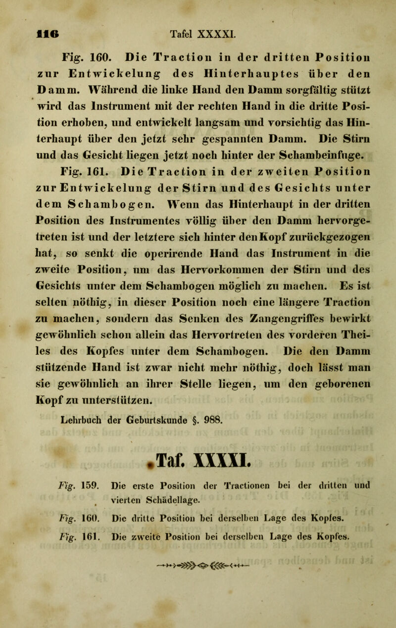 Fig. 160. Die Traction in der dritten Position zur Entwickelung des Hinterhauptes über den D amm. Während die linke Hand den Damm sorgfältig stützt wird das Instrument mit der rechten Hand in die dritte Posi- tion erhoben, und entwickelt langsam und vorsichtig das Hin- terhaupt über den jetzt sehr gespannten Damm. Die Stirn und das Gesicht liegen jetzt noch hinter der Schambeinfuge. Fig. 161. Die Traction in der zweiten Position zur Entwickelung der Stirn und des Gesichts unter dem Schambogen. Wenn das Hinterhaupt in der dritten Position des Instrumentes völlig über den Damm hervorge- treten ist und der letztere sich hinter den Kopf zurückgezogen hat, so senkt die operirende Hand das Instrument in die zweite Position, um das Hervorkommen der Stirn und des Gesichts unter dem Schambogen möglich zu machen. Es ist selten nöthig, in dieser Position noch eine längere Traction zu machen, sondern das Senken des Zangengriffes bewirkt gewöhnlich schon allein das Hervortreten des vorderen Thei- les des Kopfes unter dem Schambogen. Die den Damm stützende Hand ist zwar nicht mehr nöthig, doch lässt man sie gewöhnlich an ihrer Stelle liegen, um den geborenen Kopf zu unterstützen. Lehrbuch der Geburtskunde §. 988. .Taf. XXXXI. Fig. 159. Die erste Position der Tractionen bei der dritten und vierten Schädellage. Fig. 160. Die dritte Position bei derselben Lage des Kopfes. Fig. 161. Die zweite Position bei derselben Lage des Kopfes.