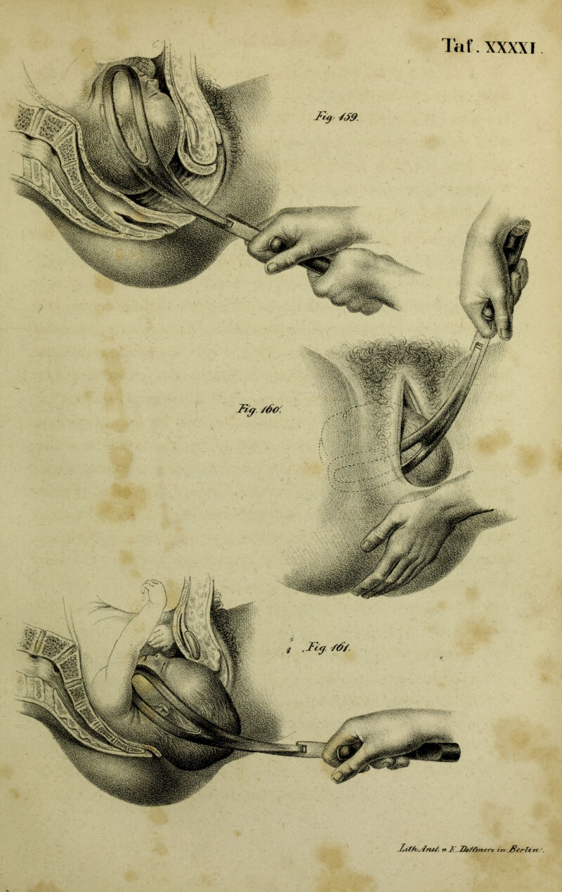 Tat'.XXXXI nt/, rt J‘, He/fontn rn Serif n