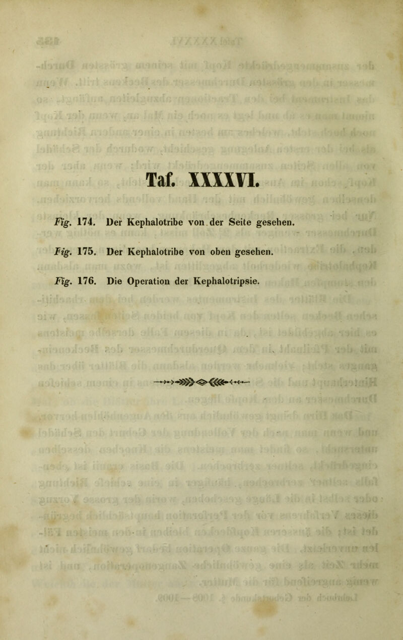 Taf. m\YI. Fig. 174. Der Kephalotribe von der Seite gesehen. Fig. 175. Der Kephalotribe von oben gesehen. Fig. 176. Die Operation der Kephalotripsie.