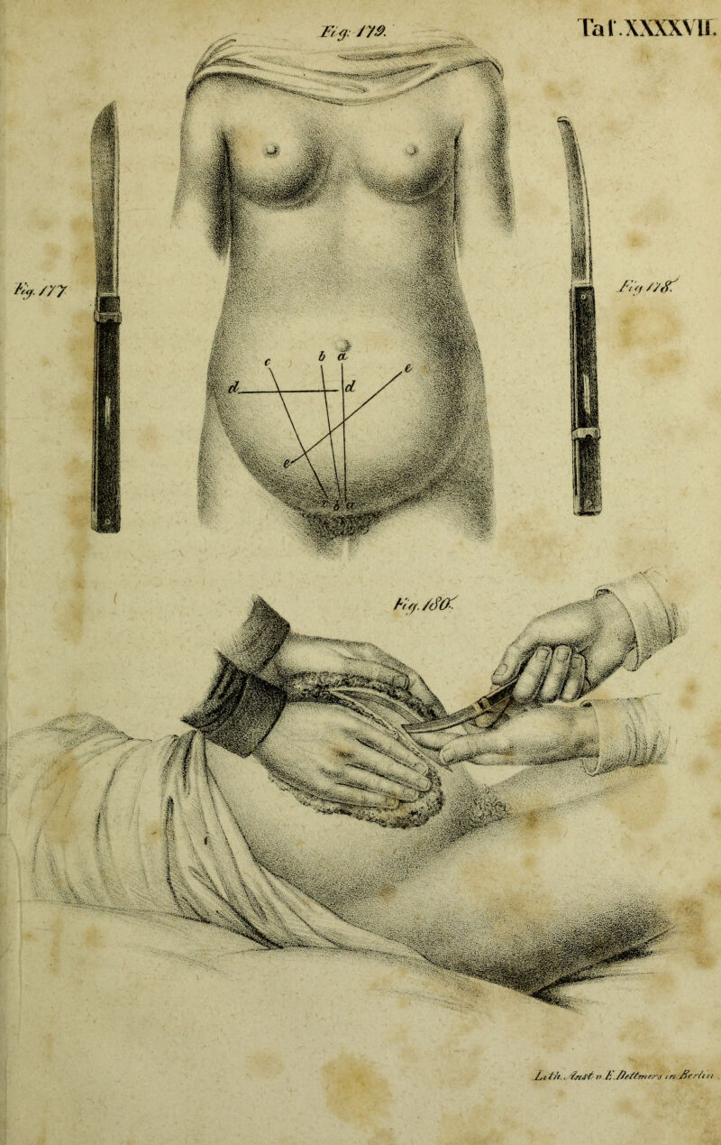 /yy. TalXXXXVU. 2,itk, 7’ tnJKtrürt