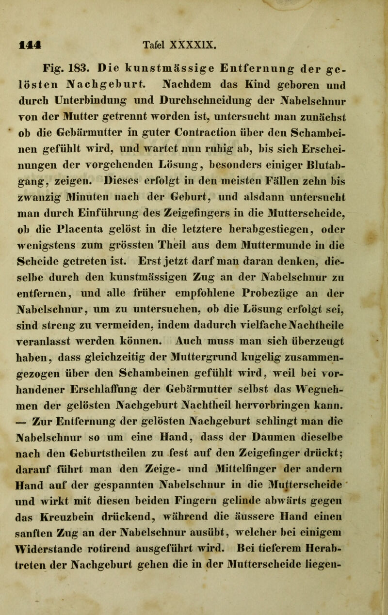 Fig. 183. Die kunstmässige Entfernung der ge- lösten Nachgeburt. Nachdem das Kind gehören und durch Unterbindung und Durchschneidung der Nabelschnur von der Mutter getrennt worden ist, untersucht man zunächst ob die Gebärmutter in guter Contraction über den Schambei- nen gefühlt wird, und wartet nun ruhig ab, bis sich Erschei- nungen der vergehenden Lösung, besonders einiger Blutab- gang, zeigen. Dieses erfolgt in den meisten Fällen zehn bis zwanzig Minuten nach der Geburt, und alsdann untersucht man durch Einführung des Zeigefingers in die Mutterscheide, ob die Placenta gelöst in die letztere herabgestiegen, oder wenigstens zum grössten Theil aus dem Muttermunde in die Scheide getreten ist. Erst jetzt darf man daran denken, die- selbe durch den kunstmässigen Zug an der Nabelschnur zu entfernen, und alle früher empfohlene Probezüge an der Nabelschnur, um zu untersuchen, ob die Lösung erfolgt sei, sind streng zu vermeiden, indem dadurch vielfache Nachtheile veranlasst werden können. Auch muss man sich überzeugt haben, dass gleichzeitig der Muttergrund kugelig zusammen- gezogen über den Schambeinen gefühlt wird, weil bei vor- handener Erschlaffung der Gebärmutter selbst das Wegneh- men der gelösten Nachgeburt Nachtheil hervorbringen kann. — Zur Entfernung der gelösten Nachgeburt schlingt man die Nabelschnur so um eine Hand, dass der Daumen dieselbe nach den Geburtstheilen zu fest auf den Zeigefinger drückt; darauf führt man den Zeige- und Mittelfinger der andern Hand auf der gespannten Nabelschnur in die Mutterscheide und wirkt mit diesen beiden Fingern gelinde abwärts gegen das Kreuzbein drückend, während die äussere Hand einen sanften Zug an der Nabelschnur ausübt, welcher bei einigem Widerstande rotirend ausgeführt wird. Bei tieferem Herab- treten der Nachgeburt gehen die in der Mutterscheide liegen-
