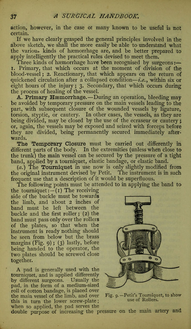 action, however, in the case ol many known to be useful is not certain. If we have clearly grasped the general principles involved in the above sketch, we shall the more easily be able to understand what the various kinds of haemorrhage are, and be better prepared to apply intelligently the practical rules devised to meet them. Three kinds of haemorrhage have been recognised by surgeons:— i. Primary, that which occurs at the moment of division of the blood-vessel; 2. Reactionary, that which appears on the return of quickened circulation after a collapsed condition—i.e., within six or eight hours of the injury; 3. Secondary, that which occurs during the process of healing of the vessel. A. Primary Haemorrhage.—During an operation, bleeding may be avoided by temporary pressure on the main vessels leading to the part, with subsequent closure of the wounded vessels by ligature, torsion, styptic, or cautery. In other cases, the vessels, as they are being divided, may be closed by the use of the ecraseur or cautery; or, again, the vessels may be exposed and seized with forceps before they are divided, being permanently secured immediately after- wards. The Temporary Closure must be carried out differently in different parts of the body. In the extremities (unless when close to the trunk) the main vessel can be secured by the pressure of a tight band, applied by a tourniquet, elastic bandage, or elastic band. (a.) The Tourniquet in use now is only slightly modified from the original instrument devised by Petit. The instrument is in such frequent use that a description of it would be superfluous. The following points must be attended to in applying the band to the tourniquet: —(1) The receiving side of the buckle must be towards the limb, and about 2 inches of band must be left between the buckle and the first roller; (2) the band must pass only over the rollers of the plates, so that when the instrument is ready nothing should be seen from below but the brass margins (Fig. 9); (3) lastly, before being handed to the operator, the two plates should be screwed close together. A pad is generally used with the tourniquet, and is applied differently by different surgeons. Usually the pad, in the form of a medium-sized roll of cotton bandage, is placed over the main vessel of the limb, and over this in turn the lower screw-plate; when so applied, the pad serves the double purpose of increasing the pressure on the main artery and Fig. 9.—Petit’s Tourniquet, to show use of Rollers.