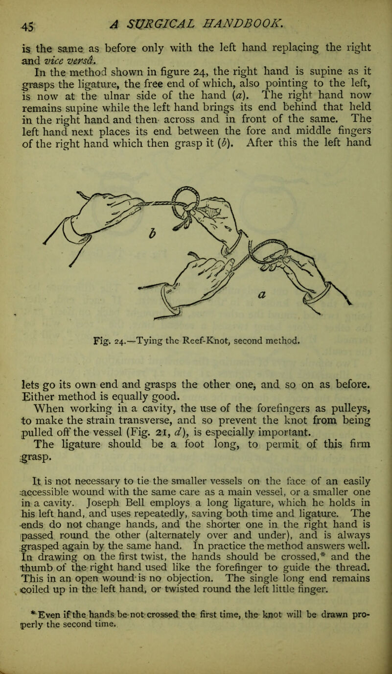 is the same as before only with the left hand replacing the right and vice versd. In the method shown in figure 24, the right hand is supine as it grasps the ligature, the free end of which, also pointing to the left, is now at the ulnar side of the hand (a). The right hand now remains supine while the left hand brings its end behind that held in the right hand and then across and in front of the same. The left hand next places its end between the fore and middle fingers of the right hand which then grasp it (b). After this the left hand Fig. 24.—Tying the Reef-Knot, second method. lets go its own end and grasps the other one, and so on as before. Either method is equally good. When working in a cavity, the use of the forefingers as pulleys, to make the strain transverse, and so prevent the knot from being pulled off the vessel (Fig. 21, d), is especially important. The ligature should be a foot long, to permit of this firm grasp. It is not necessary to tie the smaller vessels on the face of an easily accessible wound with the same care as a main vessel, or a smaller one in a cavity. Joseph Bell employs a long ligature, which he holds in his left hand, and uses repeatedly, saving both time and ligature. The ends do not change hands, and the shorter one in the right hand is passed round the other (alternately over and under), and is always grasped again by the same hand. In practice the method answers well. In drawing on the first twist, the hands should be crossed,* and the ’thumb of the right hand used like the forefinger to guide the thread. This in an open wound- is no objection. The single long end remains coiled up in the left hand, or twisted round the left little finger. * Even if the hands be not crossed the first time, the knot will be drawn pro- perly the second time.