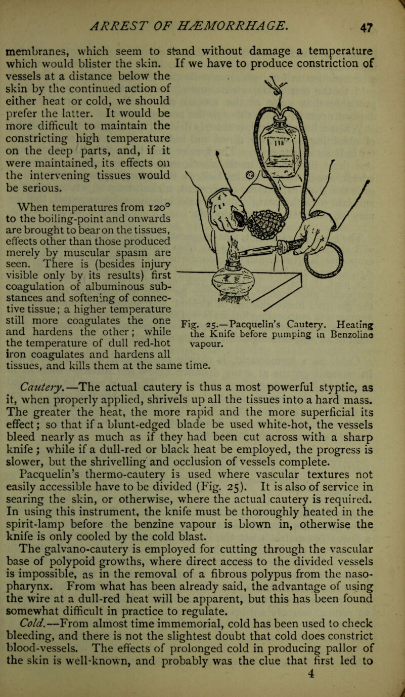membranes, which seem to stand without damage a temperature which would blister the skin. If we have to produce constriction of vessels at a distance below the skin by the continued action of either heat or cold, we should prefer the latter. It would be more difficult to maintain the constricting high temperature on the deep parts, and, if it were maintained, its effects on the intervening tissues would be serious. When temperatures from 120° to the boiling-point and onwards are brought to bear on the tissues, effects other than those produced merely by muscular spasm are seen. There is (besides injury visible only by its results) first coagulation of albuminous sub- stances and softening of connec- tive tissue; a higher temperature still more coagulates the one and hardens the other; while the temperature of dull red-hot iron coagulates and hardens all tissues, and kills them at the san time. Cautery.—The actual cautery is thus a most powerful styptic, as it, when properly applied, shrivels up all the tissues into a hard mass. The greater the heat, the more rapid and the more superficial its effect; so that if a blunt-edged blade be used white-hot, the vessels bleed nearly as much as if they had been cut across with a sharp knife ; while if a dull-red or black heat be employed, the progress is slower, but the shrivelling and occlusion of vessels complete. Pacquelin’s thermo-cautery is used where vascular textures not easily accessible have to be divided (Fig. 25). It is also of service in searing the skin, or otherwise, where the actual cautery is required. In using this instrument, the knife must be thoroughly heated in the spirit-lamp before the benzine vapour is blown in, otherwise the knife is only cooled by the cold blast. The galvano-cautery is employed for cutting through the vascular base of polypoid growths, where direct access to the divided vessels is impossible, as in the removal of a fibrous polypus from the naso- pharynx. From what has been already said, the advantage of using the wire at a dull-red heat will be apparent, but this has been found somewhat difficult in practice to regulate. Cold.—From almost time immemorial, cold has been used to check bleeding, and there is not the slightest doubt that cold does constrict blood-vessels. The effects of prolonged cold in producing pallor of the skin is well-known, and probably was the clue that first led to 4