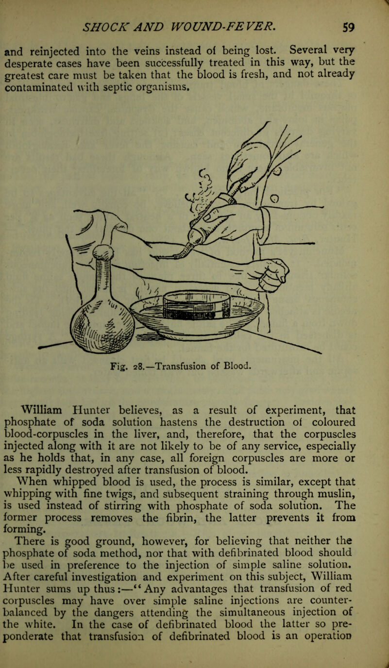 and reinjected into the veins instead ol being lost. Several very desperate cases have been successfully treated in this way, but the greatest care must be taken that the blood is fresh, and not already contaminated with septic organisms. William Hunter believes, as a result of experiment, that phosphate of soda solution hastens the destruction of coloured blood-corpuscles in the liver, and, therefore, that the corpuscles injected along with it are not likely to be of any service, especially as he holds that, in any case, all foreign corpuscles are more or less rapidly destroyed after transfusion of blood. When whipped blood is used, the process is similar, except that whipping with fine twigs, and subsequent straining through muslin, is used instead of stirring with phosphate of soda solution. The former process removes the fibrin, the latter prevents it from forming. There is good ground, however, for believing that neither the phosphate of soda method, nor that with defibrinated blood should be used in preference to the injection of simple saline solution. After careful investigation and experiment on this subject, William Hunter sums up thus:—“Any advantages that transfusion of red corpuscles may have over simple saline injections are counter- balanced by the dangers attending the simultaneous injection of the white. In the case of defibrinated blood the latter so pre- ponderate that transfusion of defibrinated blood is an operation