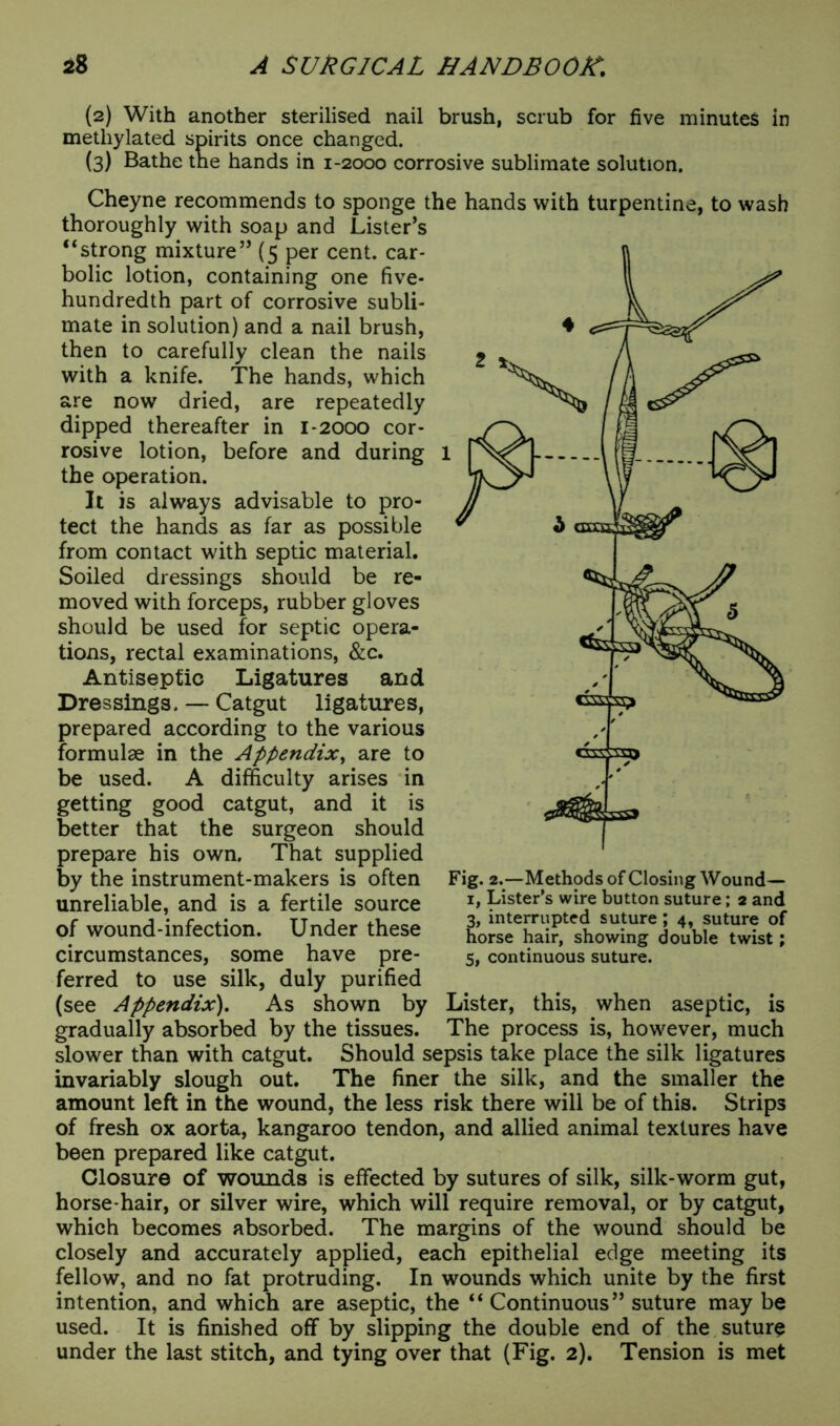 (2) With another sterilised nail brush, scrub for five minutes in methylated spirits once changed. (3) Bathe the hands in 1-2000 corrosive sublimate solution. Cheyne recommends to sponge the hands with turpentine, to wash thoroughly with soap and Lister’s “strong mixture” (5 per cent, car- bolic lotion, containing one five- hundredth part of corrosive subli- mate in solution) and a nail brush, then to carefully clean the nails with a knife. The hands, which are now dried, are repeatedly dipped thereafter in I-2000 cor- rosive lotion, before and during the operation. It is always advisable to pro- tect the hands as far as possible from contact with septic material. Soiled dressings should be re- moved with forceps, rubber gloves should be used for septic opera- tions, rectal examinations, &c. Antiseptic Ligatures and Dressings. — Catgut ligatures, prepared according to the various formulae in the Appendix, are to be used. A difficulty arises in getting good catgut, and it is better that the surgeon should prepare his own. That supplied by the instrument-makers is often unreliable, and is a fertile source of wound-infection. Under these circumstances, some have pre- ferred to use silk, duly purified (see Appendix). As shown by Lister, this, when aseptic, is gradually absorbed by the tissues. The process is, however, much slower than with catgut. Should sepsis take place the silk ligatures invariably slough out. The finer the silk, and the smaller the amount left in the wound, the less risk there will be of this. Strips of fresh ox aorta, kangaroo tendon, and allied animal textures have been prepared like catgut. Closure of wounds is effected by sutures of silk, silk-worm gut, horse hair, or silver wire, which will require removal, or by catgut, which becomes absorbed. The margins of the wound should be closely and accurately applied, each epithelial edge meeting its fellow, and no fat protruding. In wounds which unite by the first intention, and which are aseptic, the “Continuous” suture may be used. It is finished off by slipping the double end of the suture under the last stitch, and tying over that (Fig. 2). Tension is met 3, interrupted suture ; 4, suture of horse hair, showing double twist; 5, continuous suture.